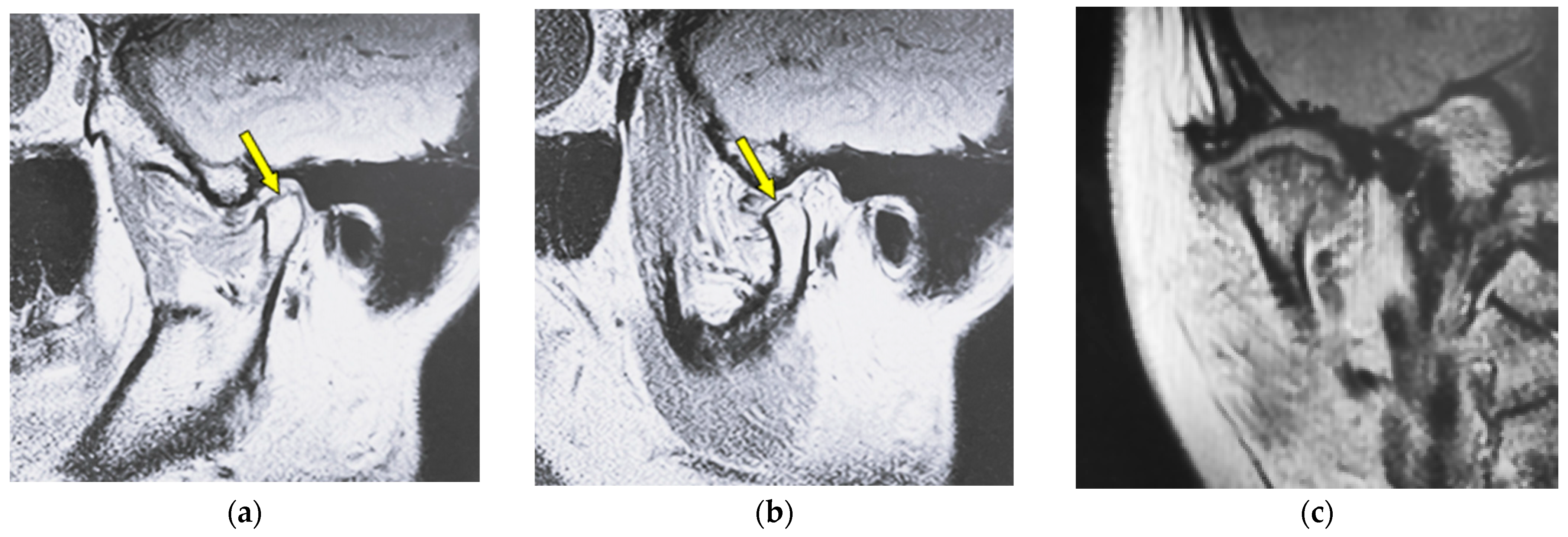 Jimaging 12 00005 g002