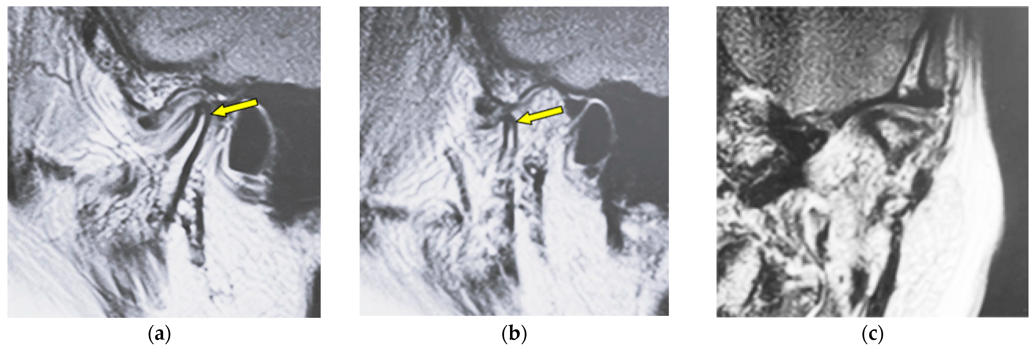 Jimaging 12 00005 g004