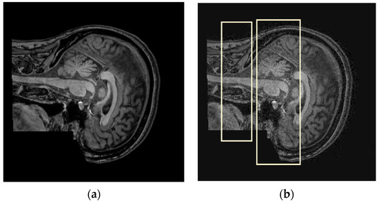 mri anal plug Tom's Butt Story of the Week: An MRI Gone Wrong main image 1