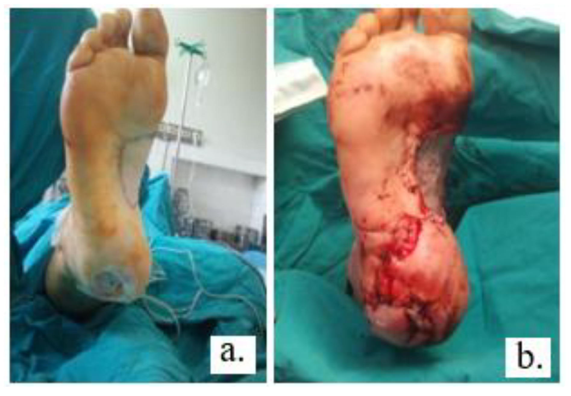 Jmms 05 00037 g002 Jmms 05 00037 g002