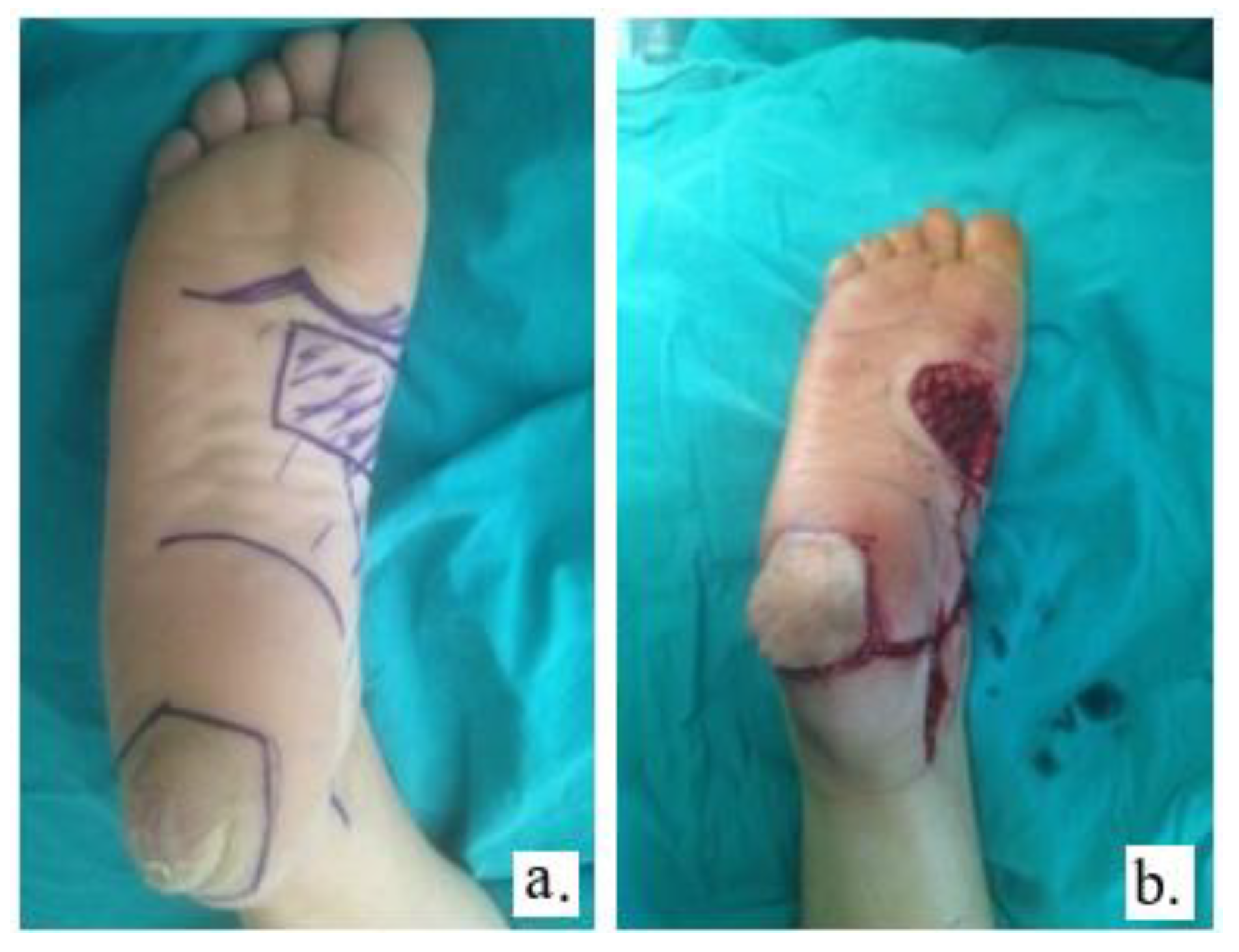 Jmms 05 00037 g003 Jmms 05 00037 g003