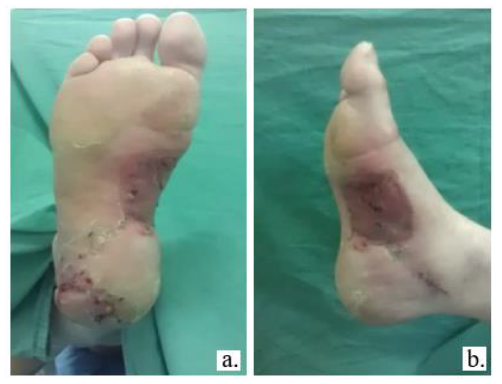 Jmms 05 00037 g004 Jmms 05 00037 g004