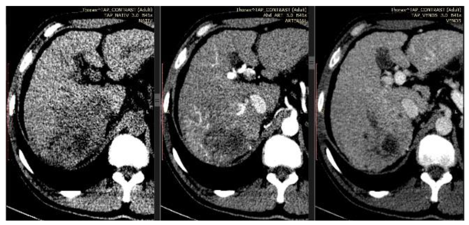 Jmms 05 00044 g001 Jmms 05 00044 g001