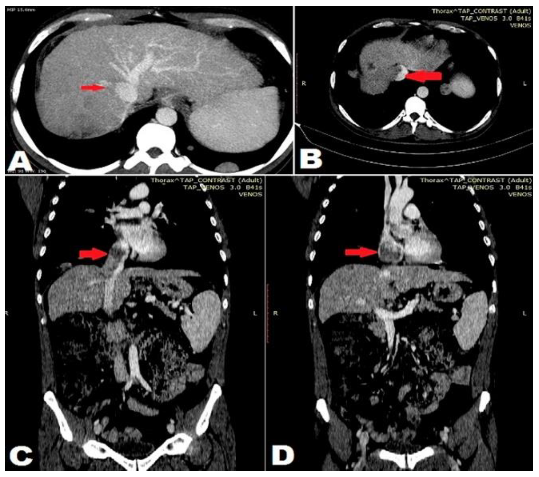 Jmms 05 00044 g002 Jmms 05 00044 g002