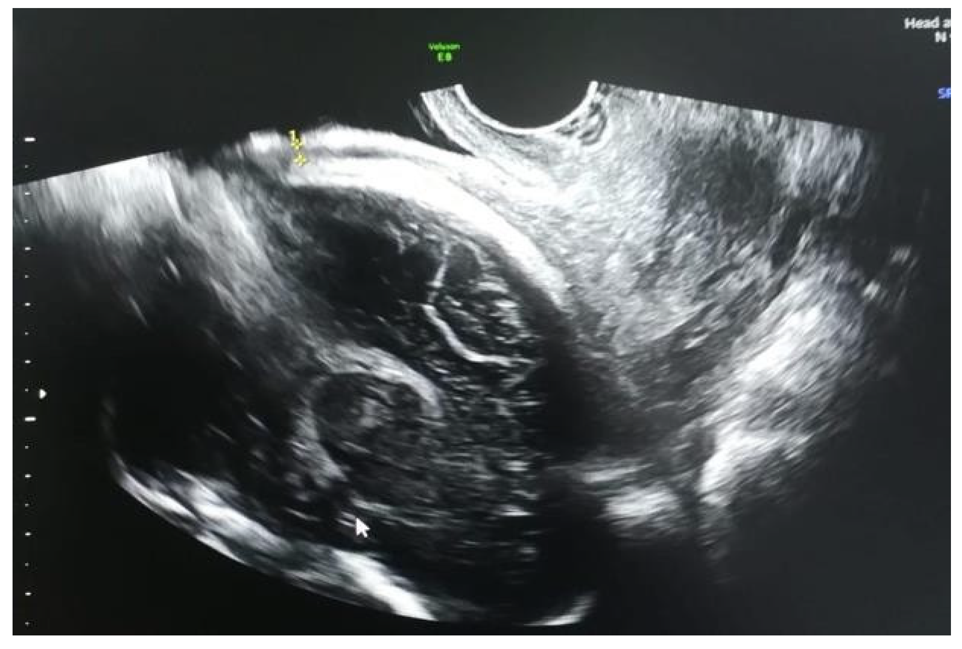 Jmms 06 00021 g004 Jmms 06 00021 g004