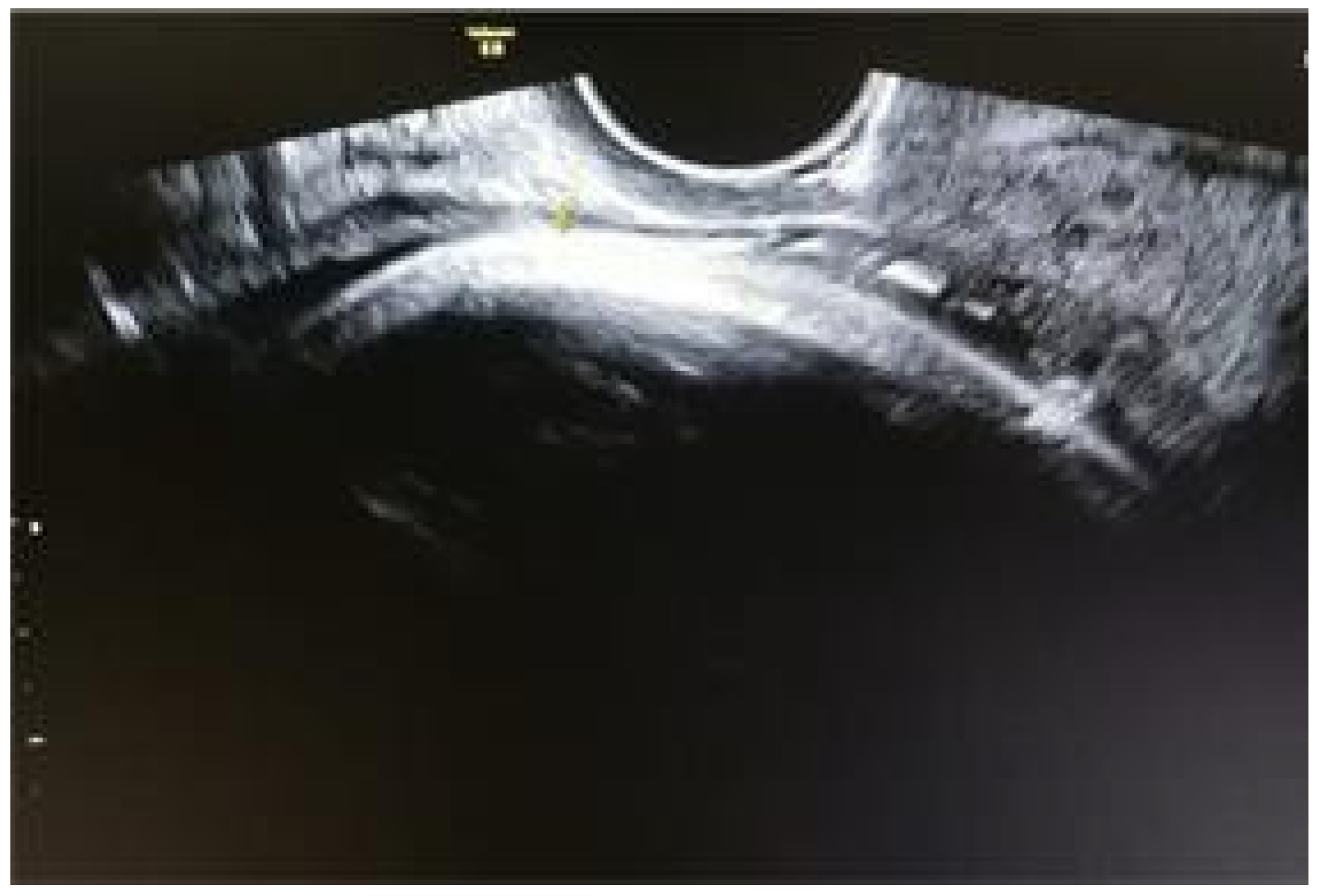 Jmms 06 00021 g005 Jmms 06 00021 g005