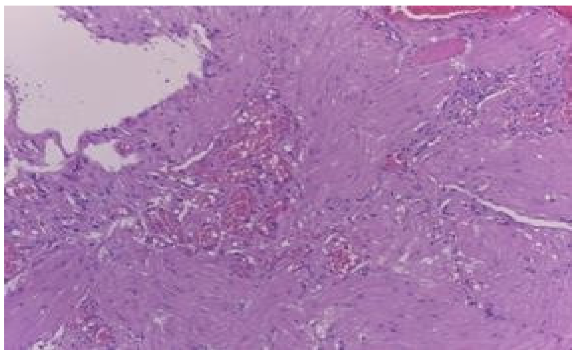 Jmms 06 00021 g008 Jmms 06 00021 g008