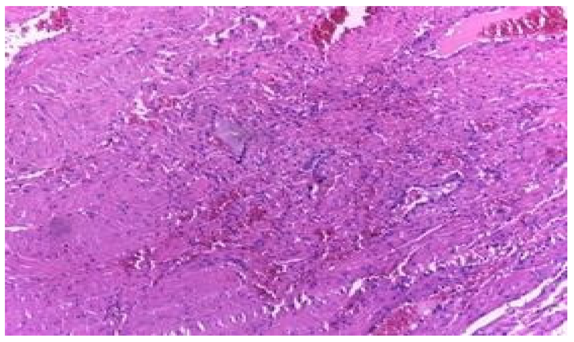 Jmms 06 00021 g009 Jmms 06 00021 g009