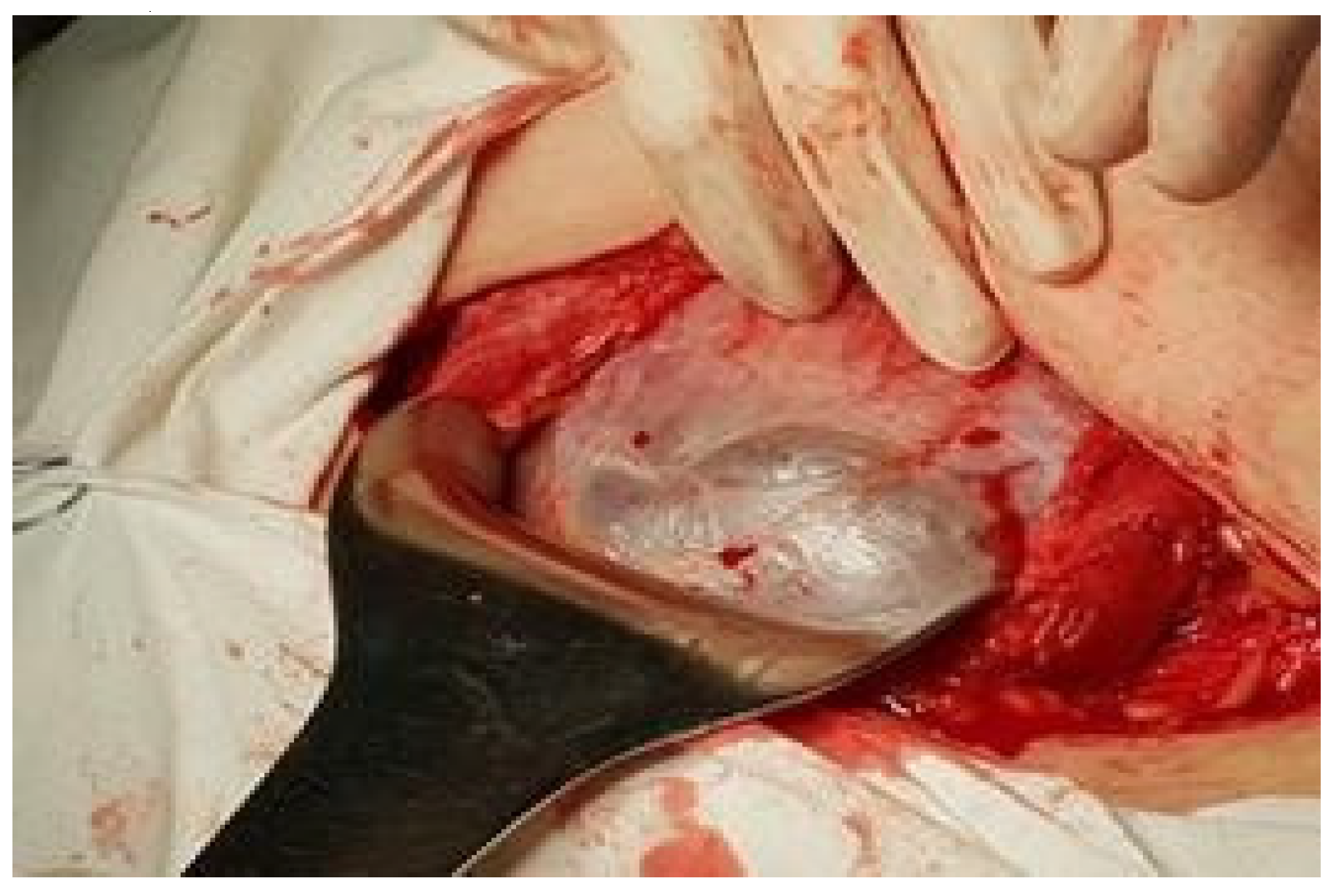 Jmms 06 00021 g010 Jmms 06 00021 g010