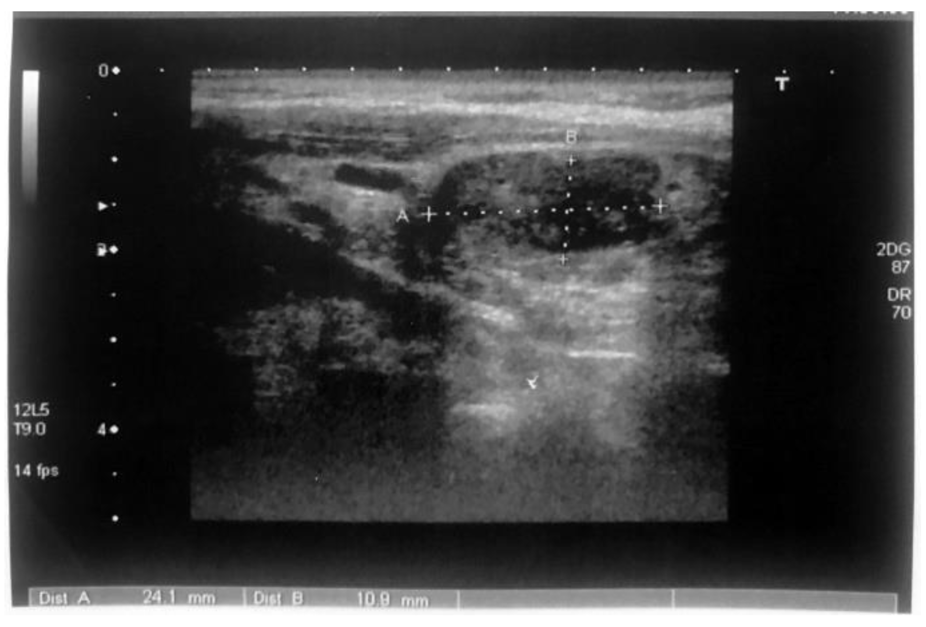 Jmms 06 00051 g005 Jmms 06 00051 g005