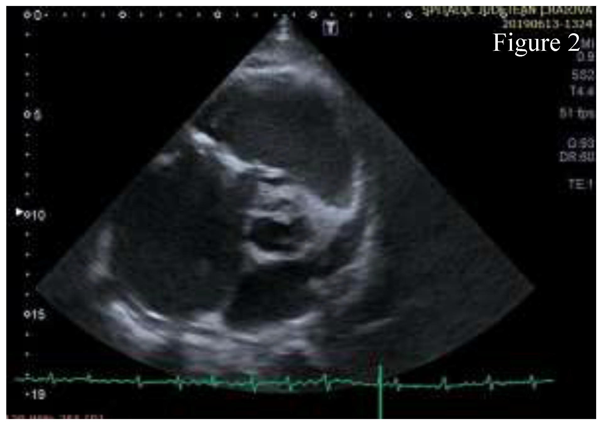 Jmms 07 00020 g002