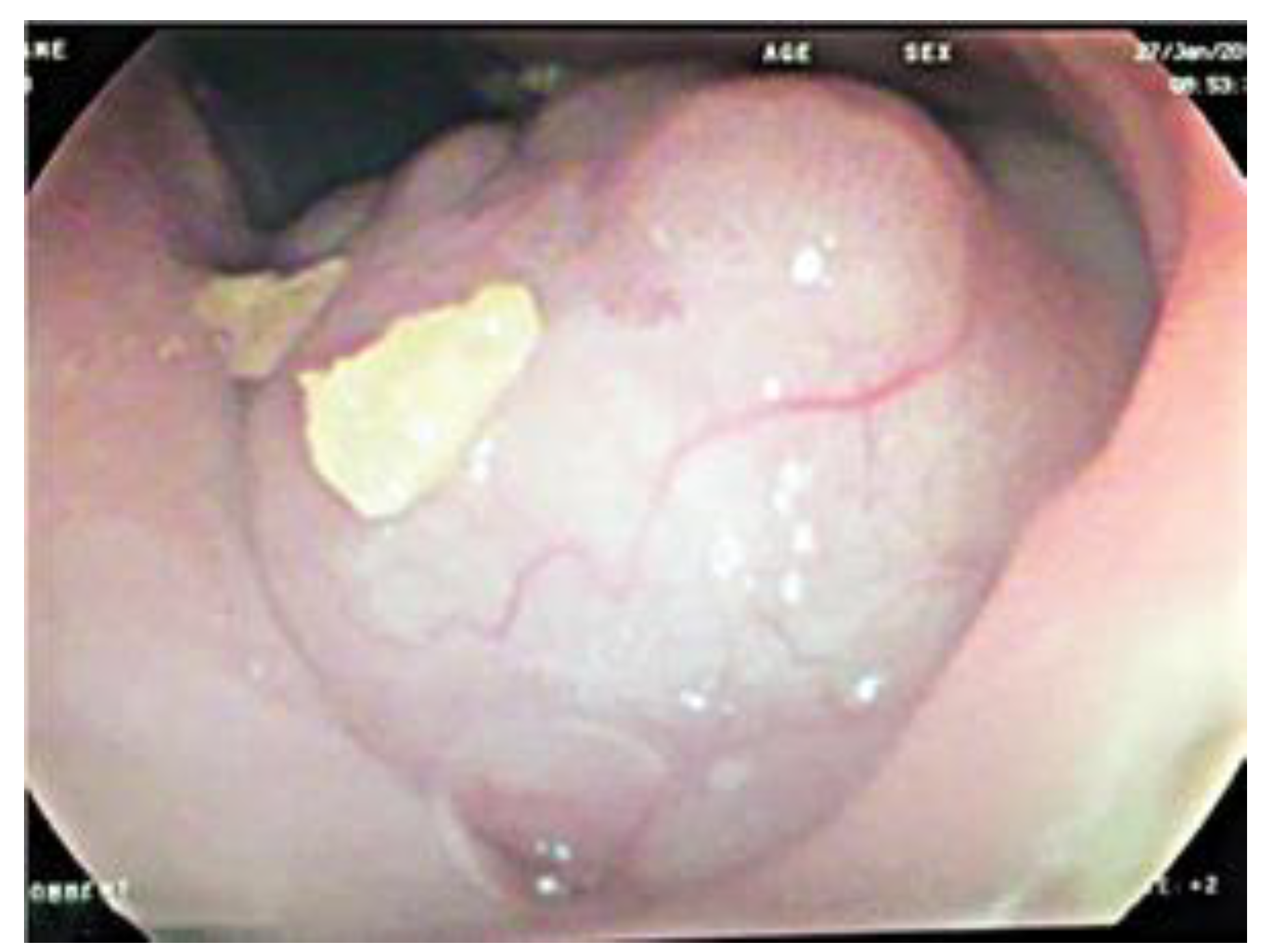 Jmms 08 00021 g004 Jmms 08 00021 g004