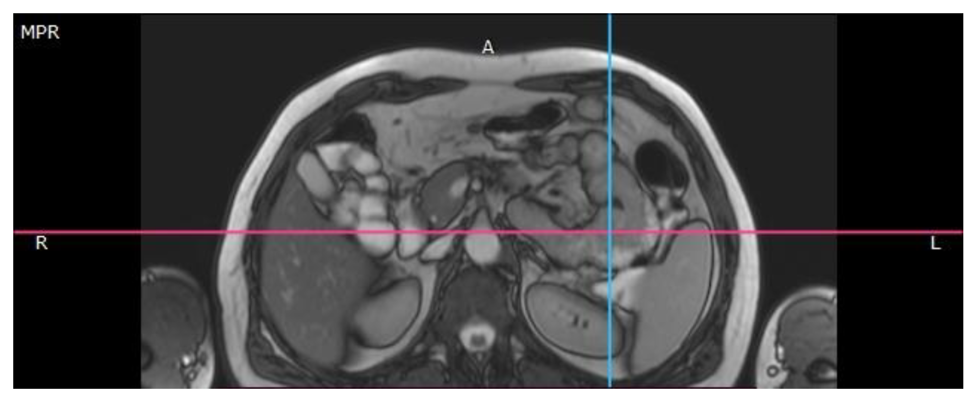Jmms 09 00020 g002 Jmms 09 00020 g002