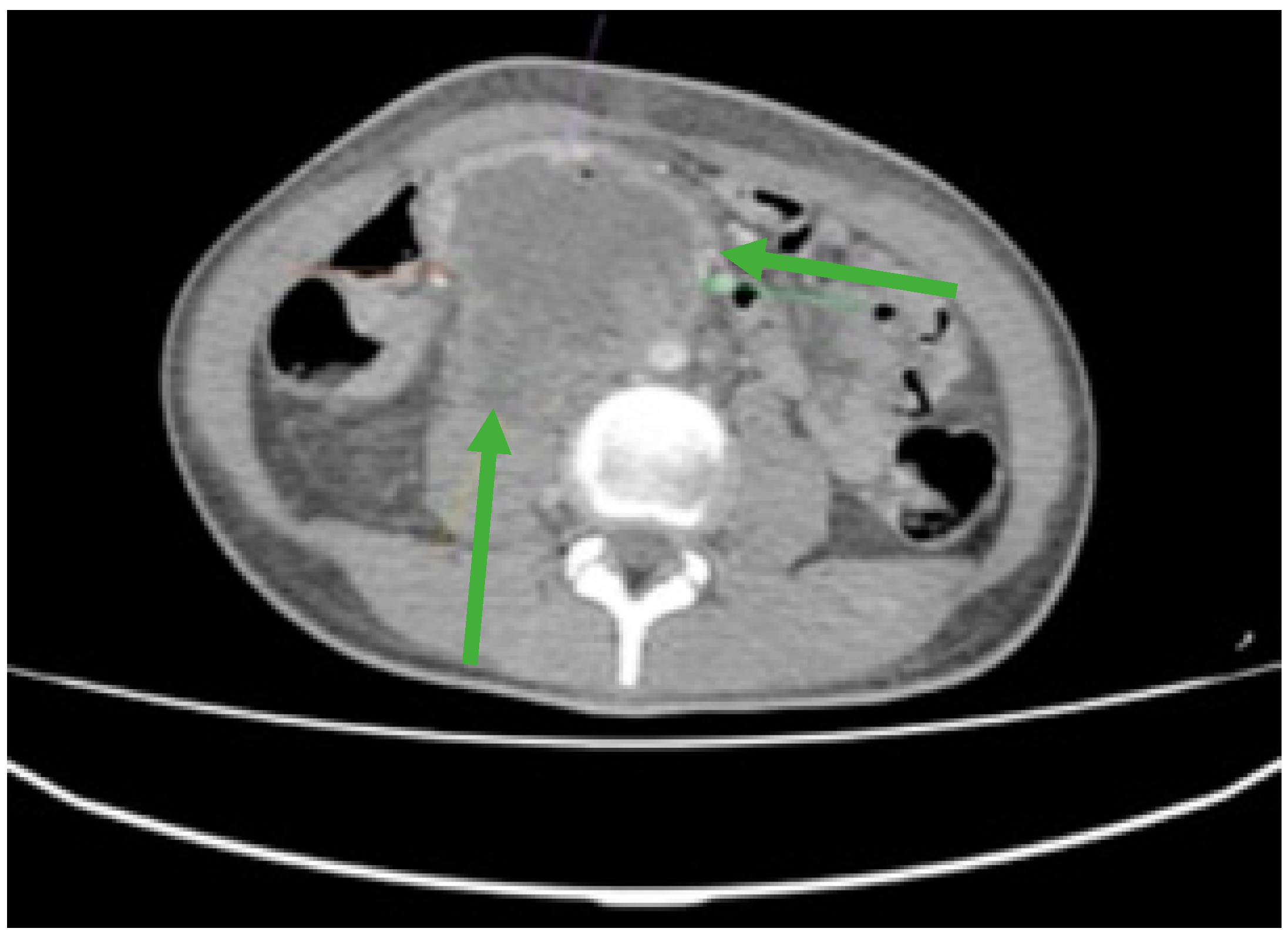 Jmms 12 00030 g001 Jmms 12 00030 g001