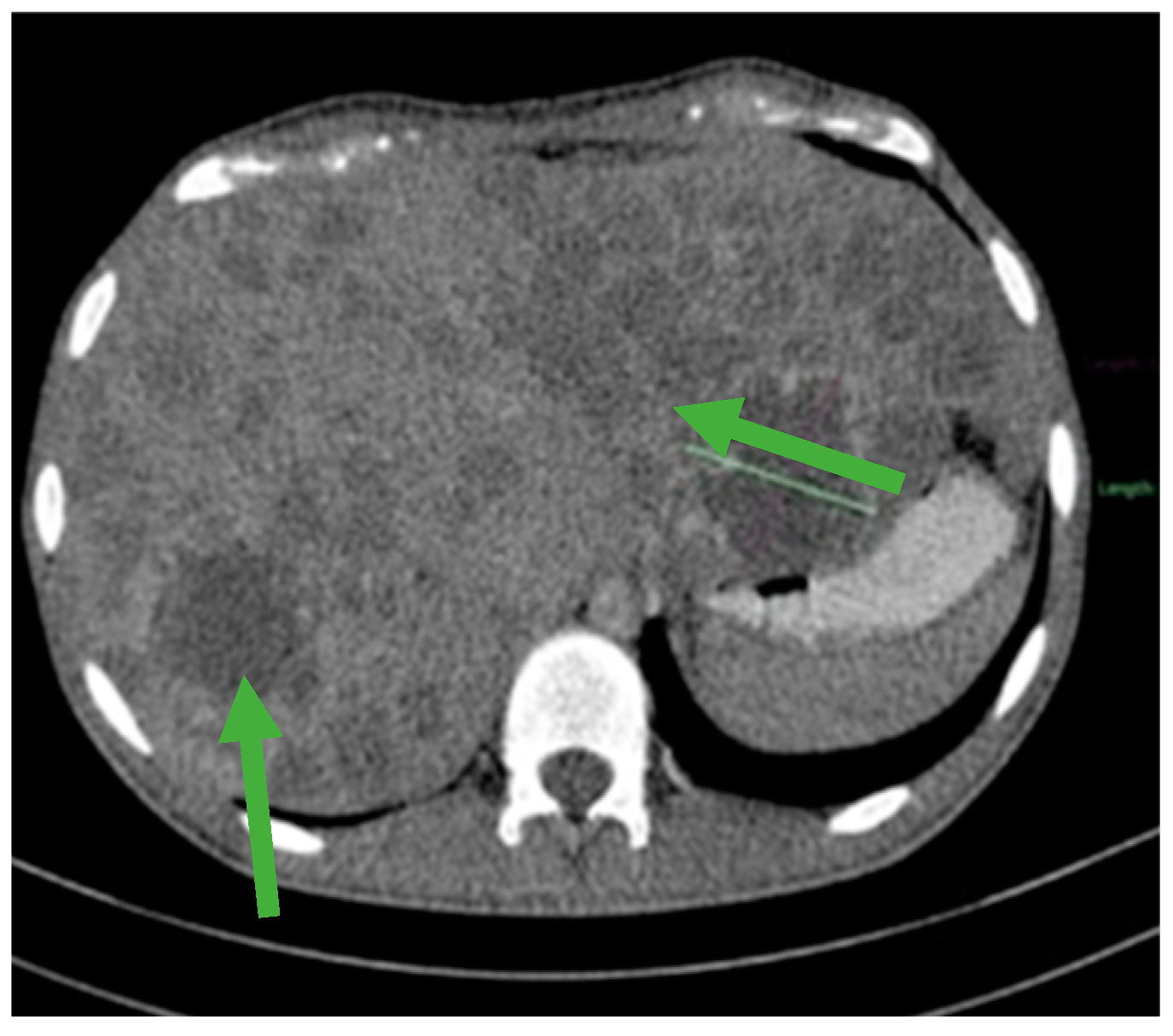 Jmms 12 00030 g003 Jmms 12 00030 g003
