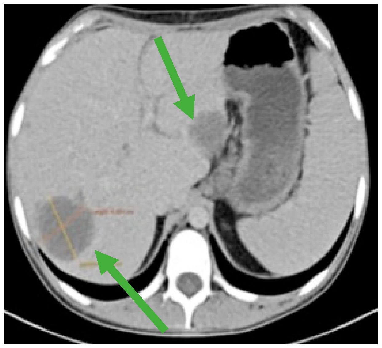 Jmms 12 00030 g004 Jmms 12 00030 g004