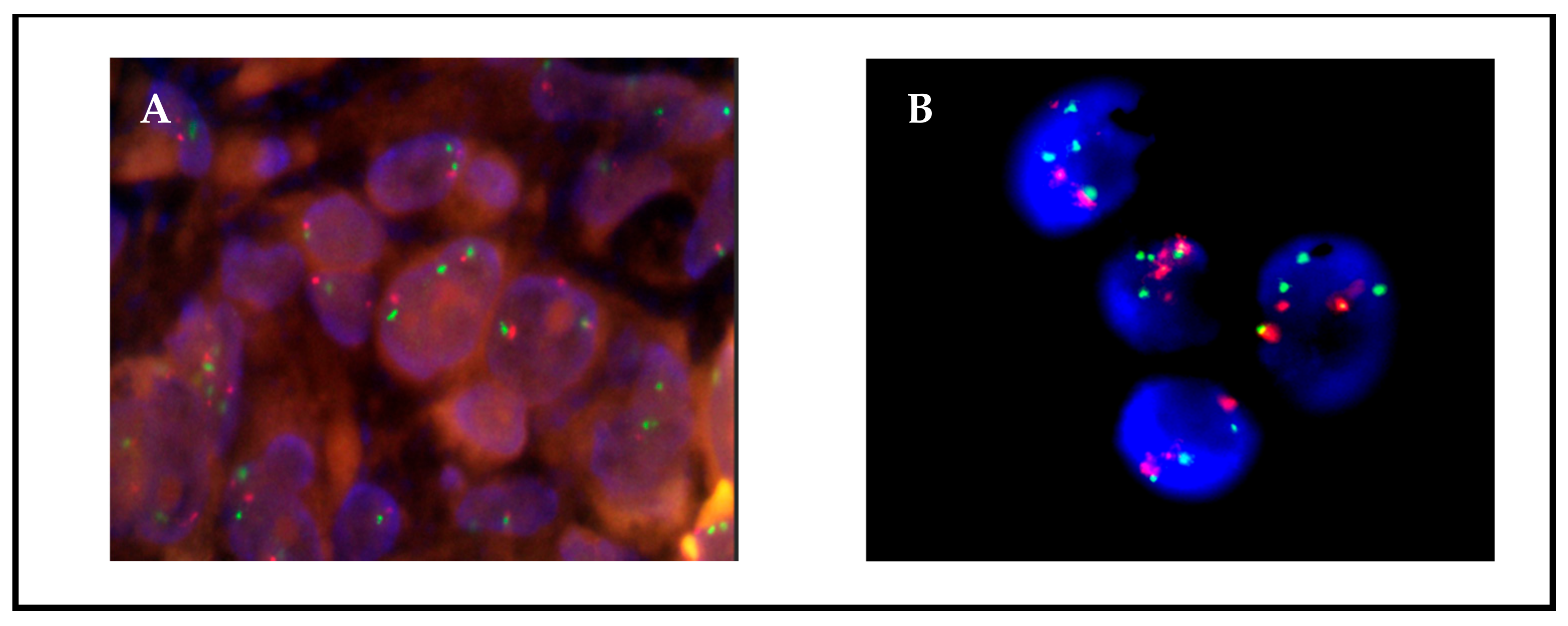 JMP | Free Full-Text | Fluorescence In Situ Hybridization (FISH) for ...