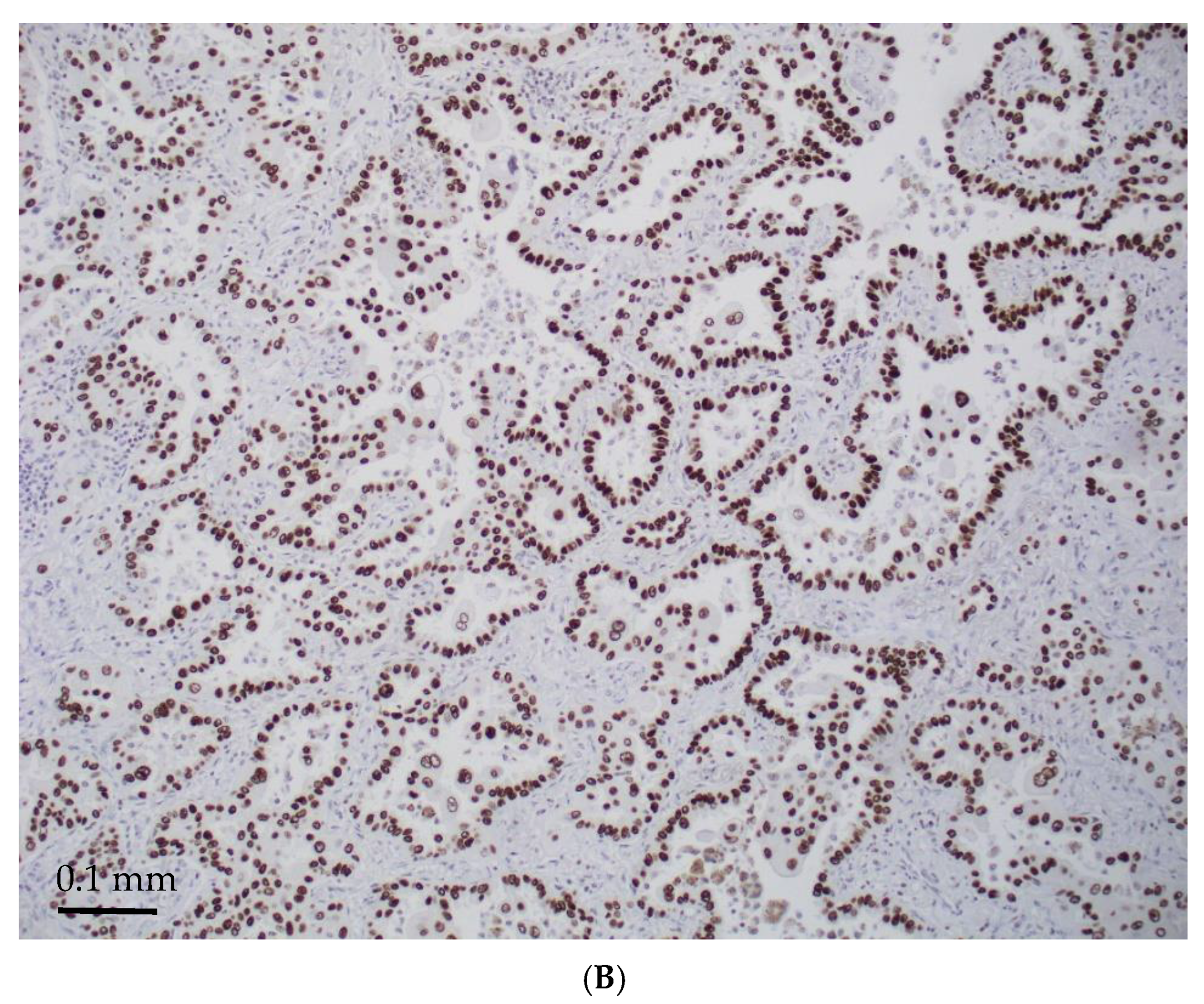 Jmp 06 00028 g003b Jmp 06 00028 g003b