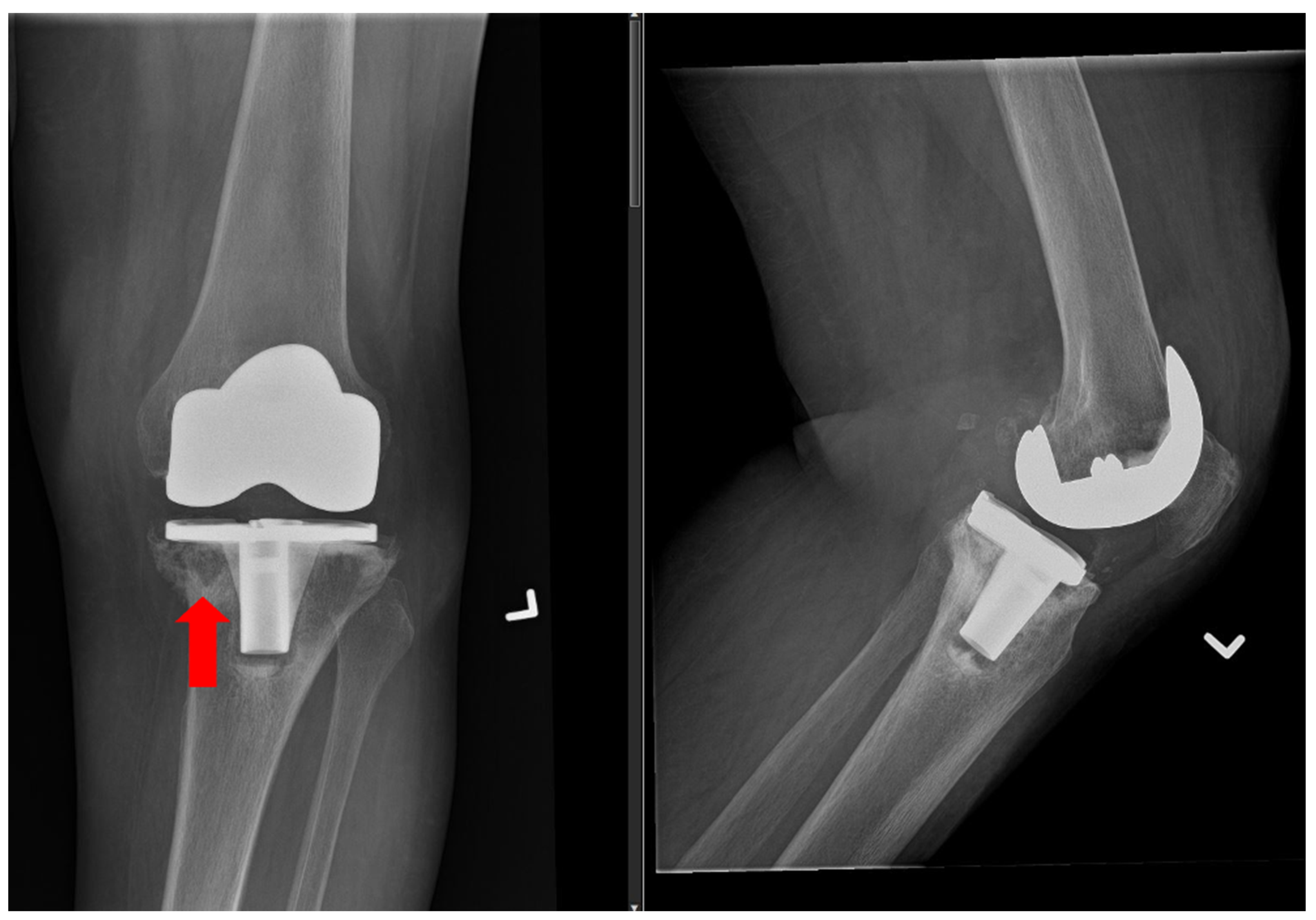 Jnt 05 00011 g002 Jnt 05 00011 g002