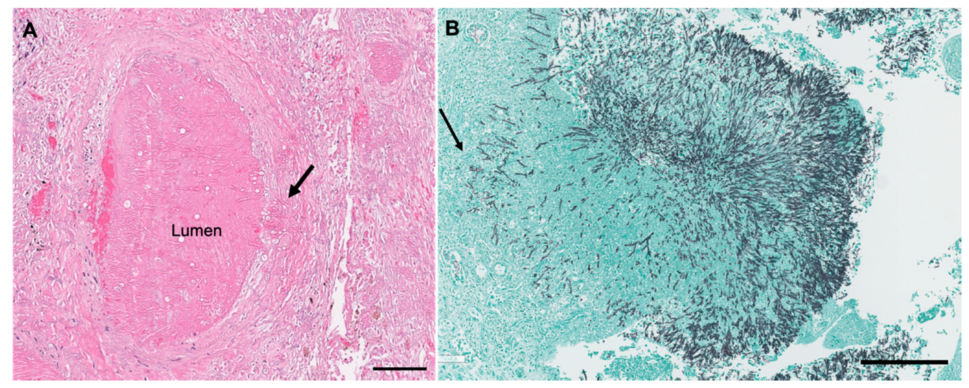 Jof 06 00106 g002 Jof 06 00106 g002