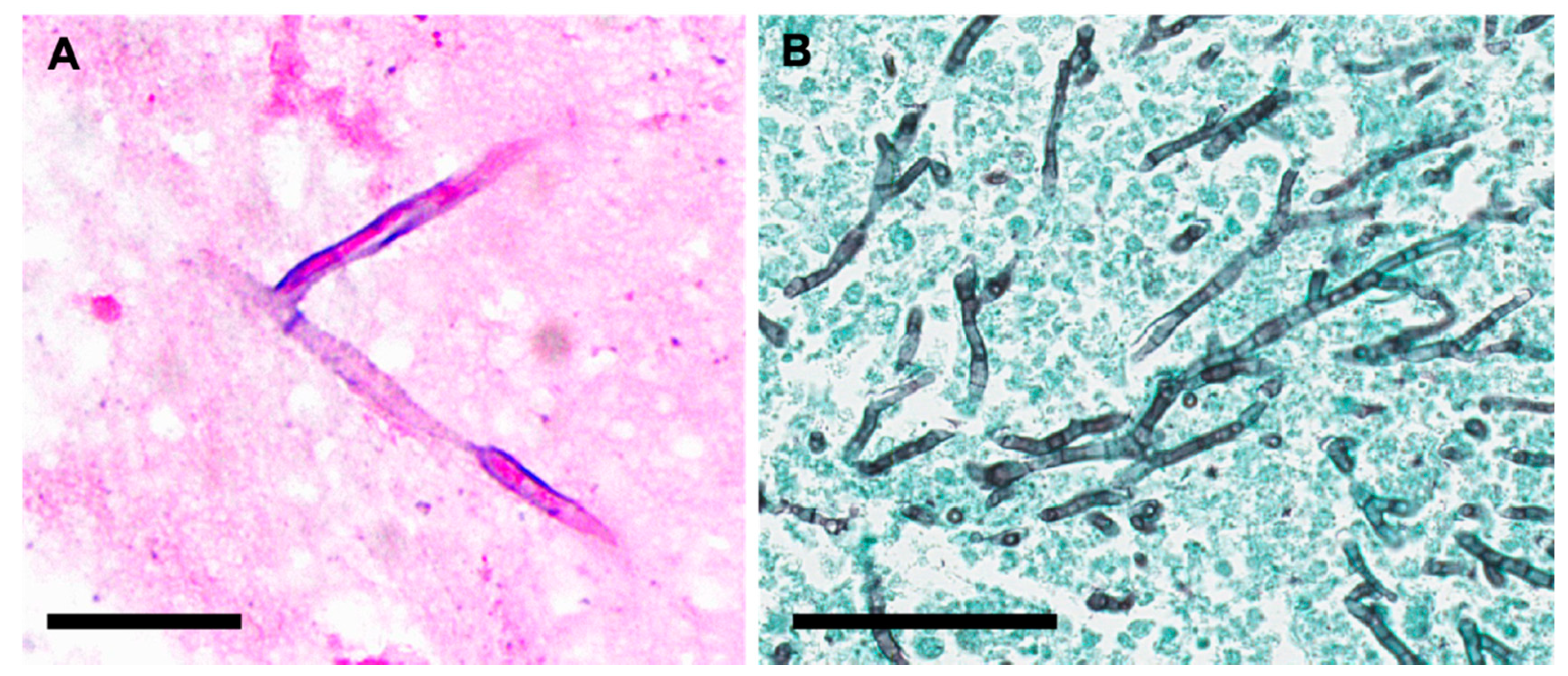 Jof 06 00106 g004 Jof 06 00106 g004