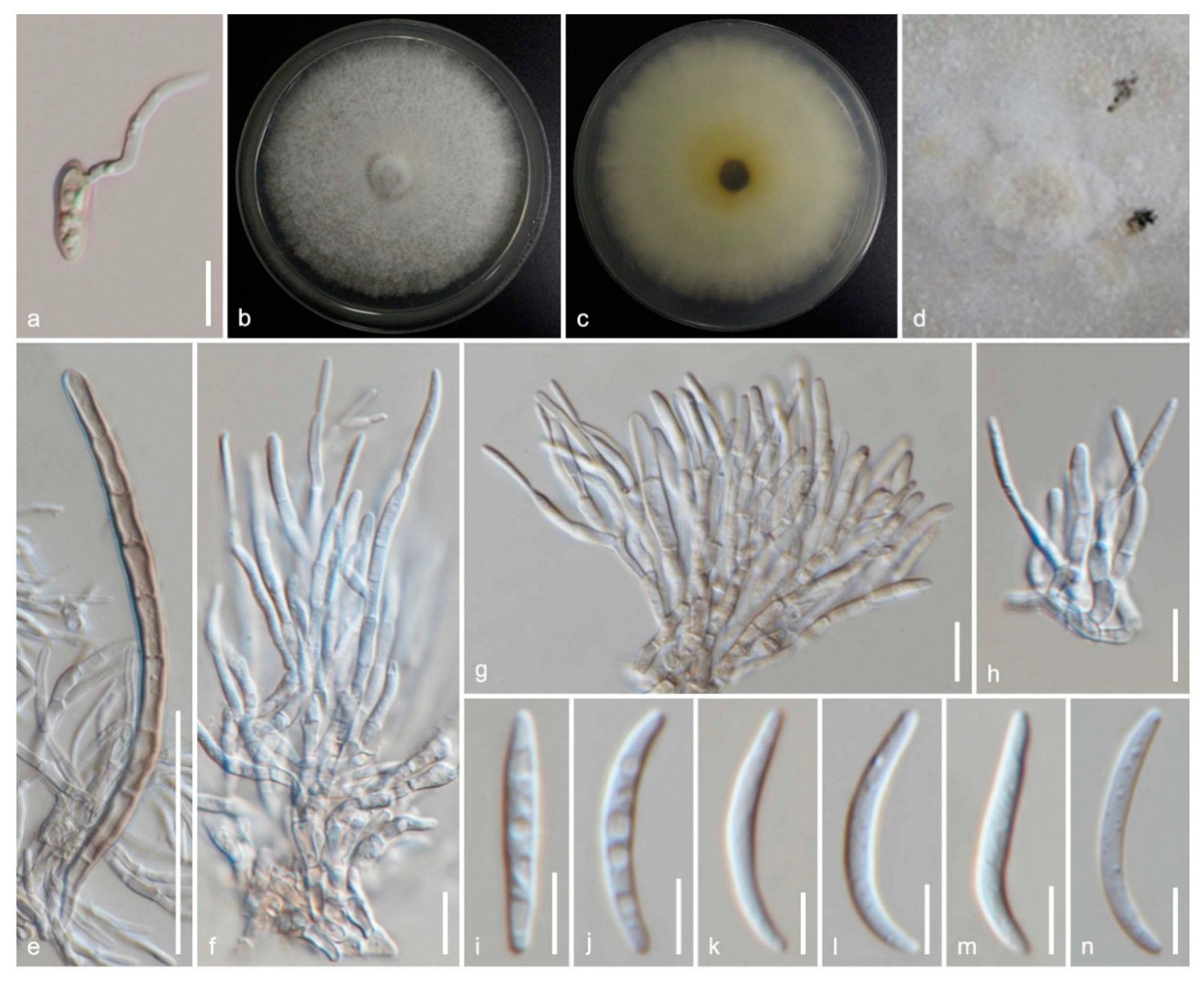 Jof 06 00174 g004 Jof 06 00174 g004