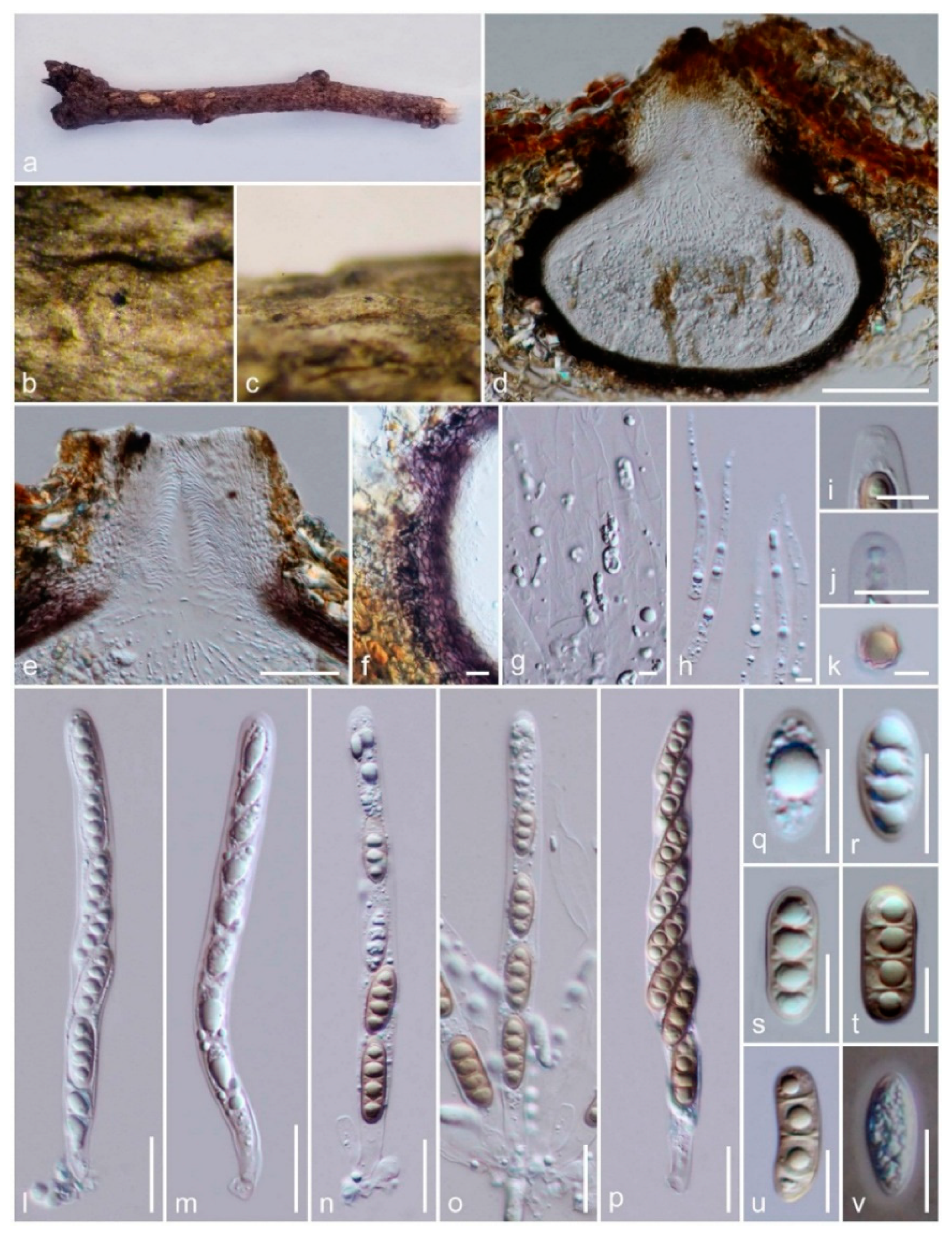 Jof 06 00174 g005 Jof 06 00174 g005