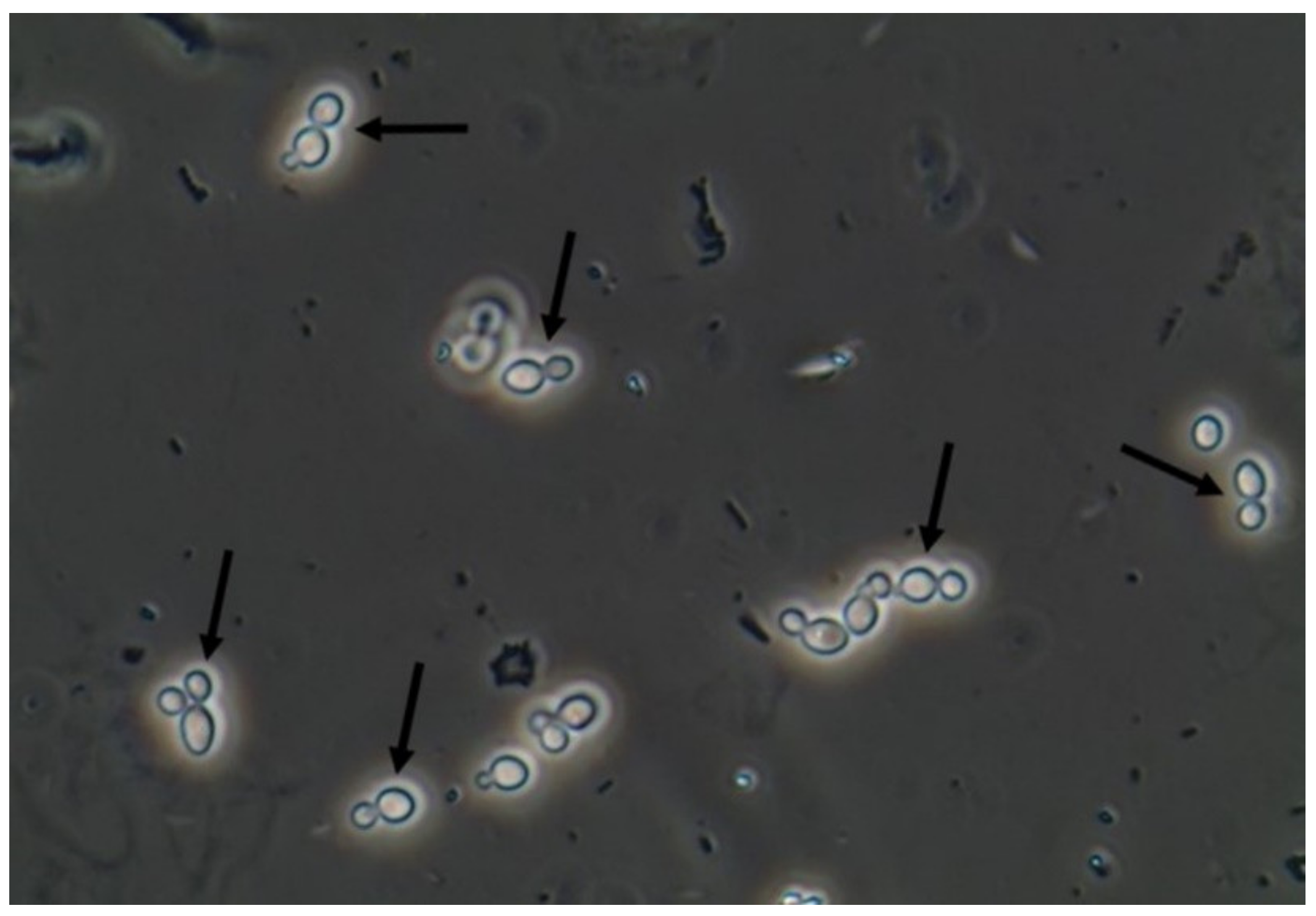 Candida Albicans Microscope Slide