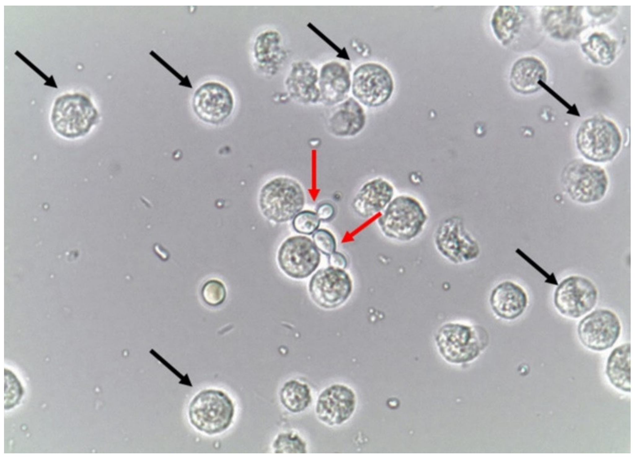 Candida albicans лечение