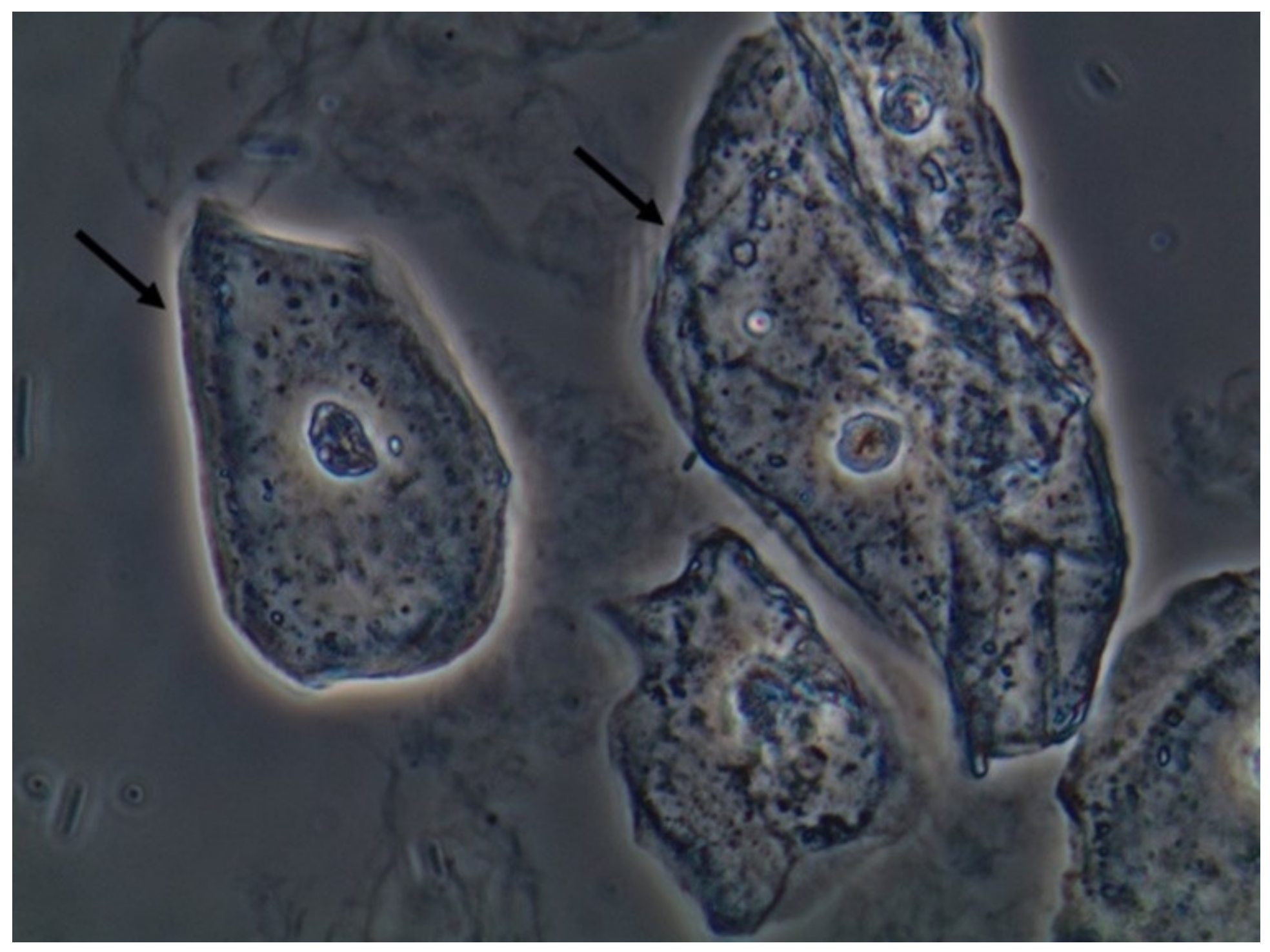 JoF Free FullText Urine Sediment Findings and the Immune Response