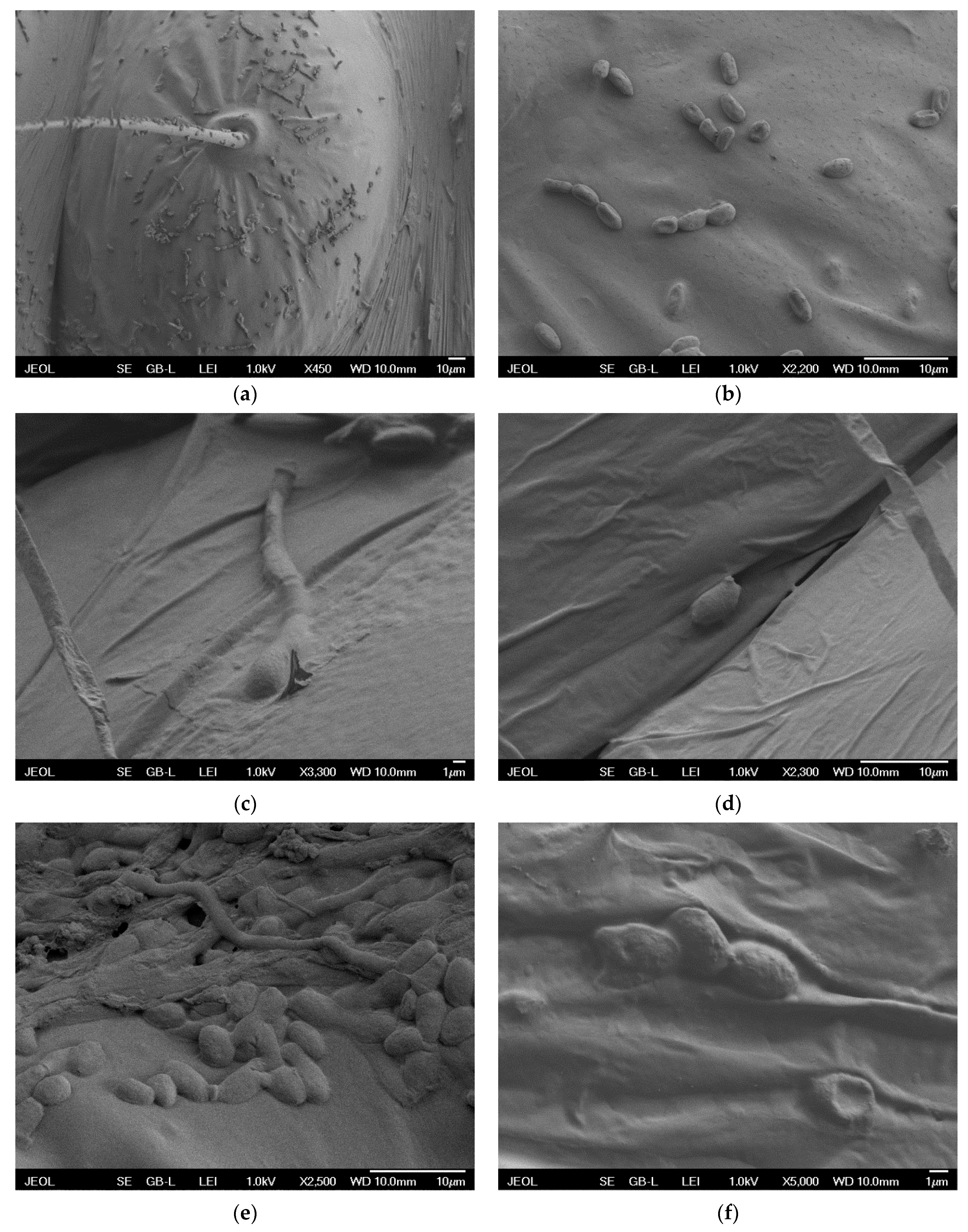 Jof 06 00342 g004 Jof 06 00342 g004