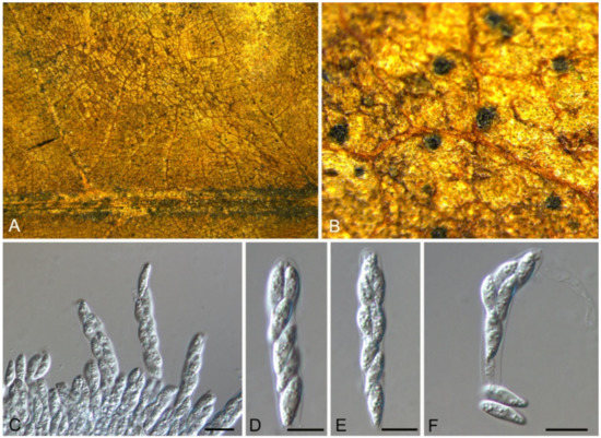 Identification and Characterization of Leaf-Inhabiting Fungi Identification and Characterization of Leaf-Inhabiting Fungi
