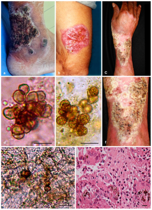 Jof 07 00095 g001 Jof 07 00095 g001