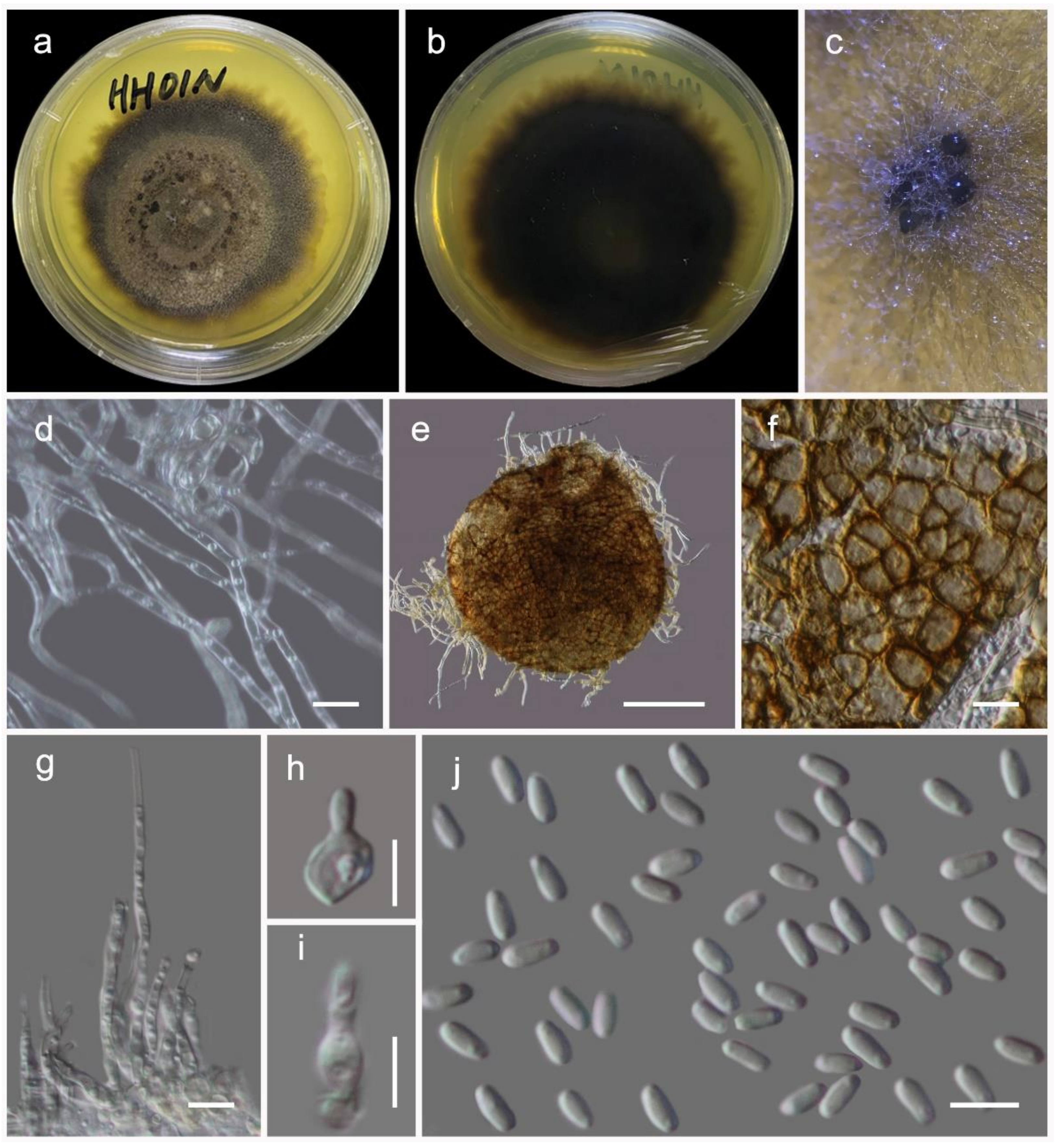 Insight into the Systematics of Microfungi Colonizing Dead