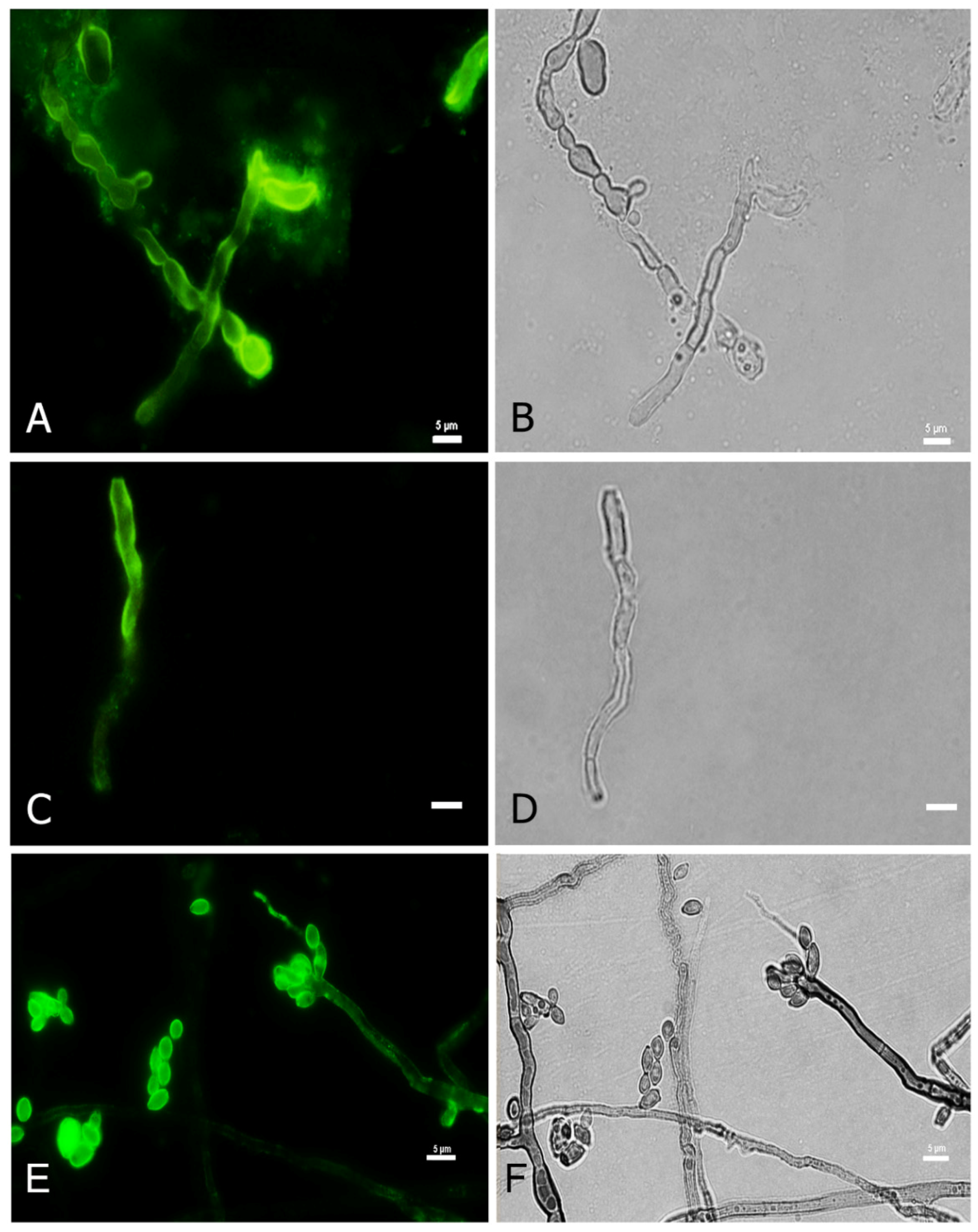 Jof 07 00475 g004 Jof 07 00475 g004