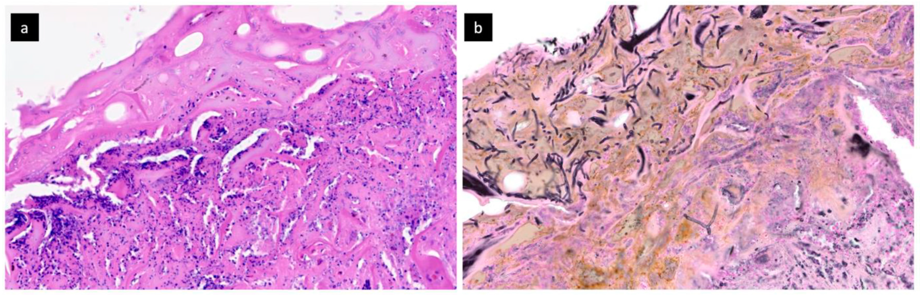 Jof 07 00487 g002 Jof 07 00487 g002