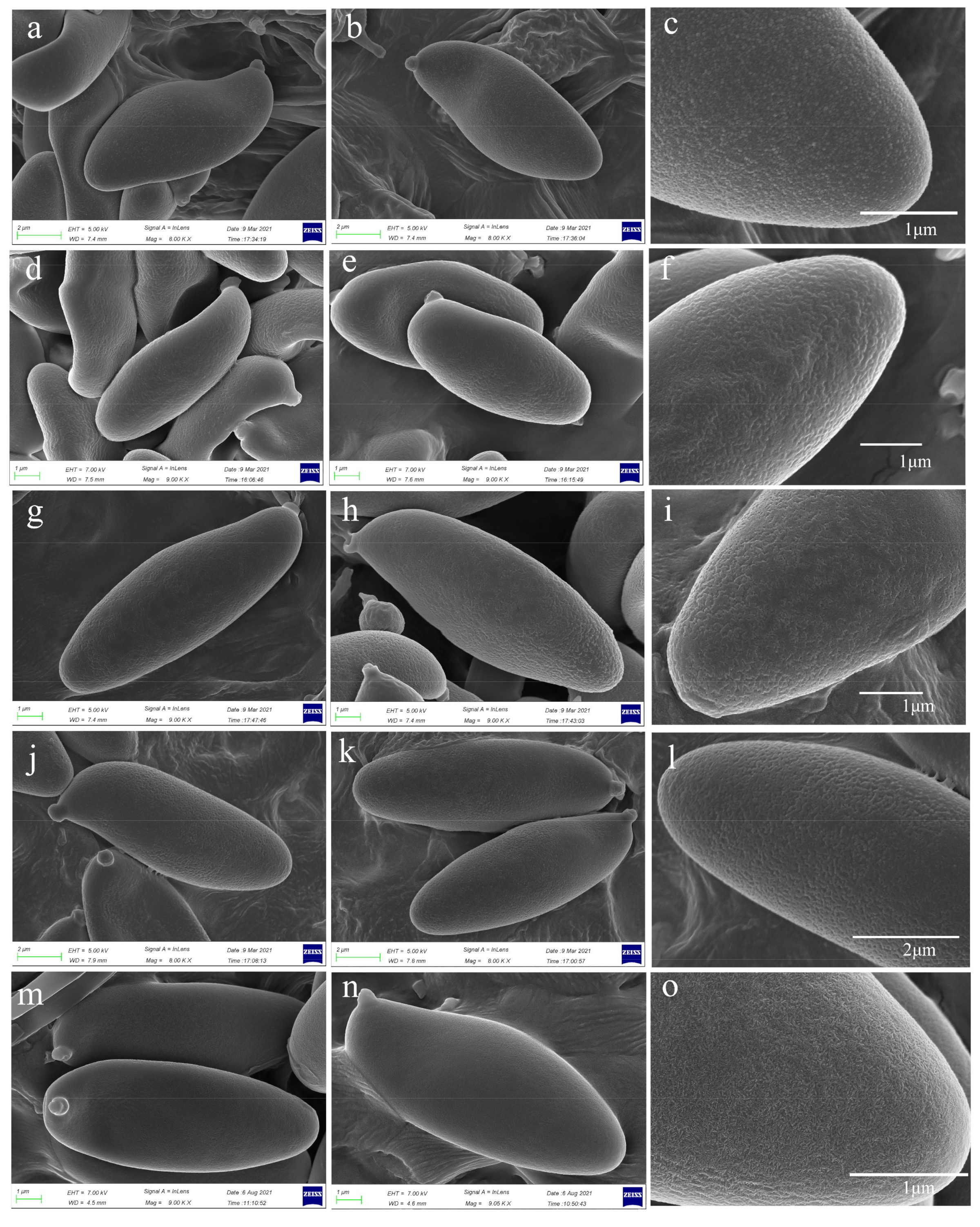 Jof 07 00823 g004 Jof 07 00823 g004