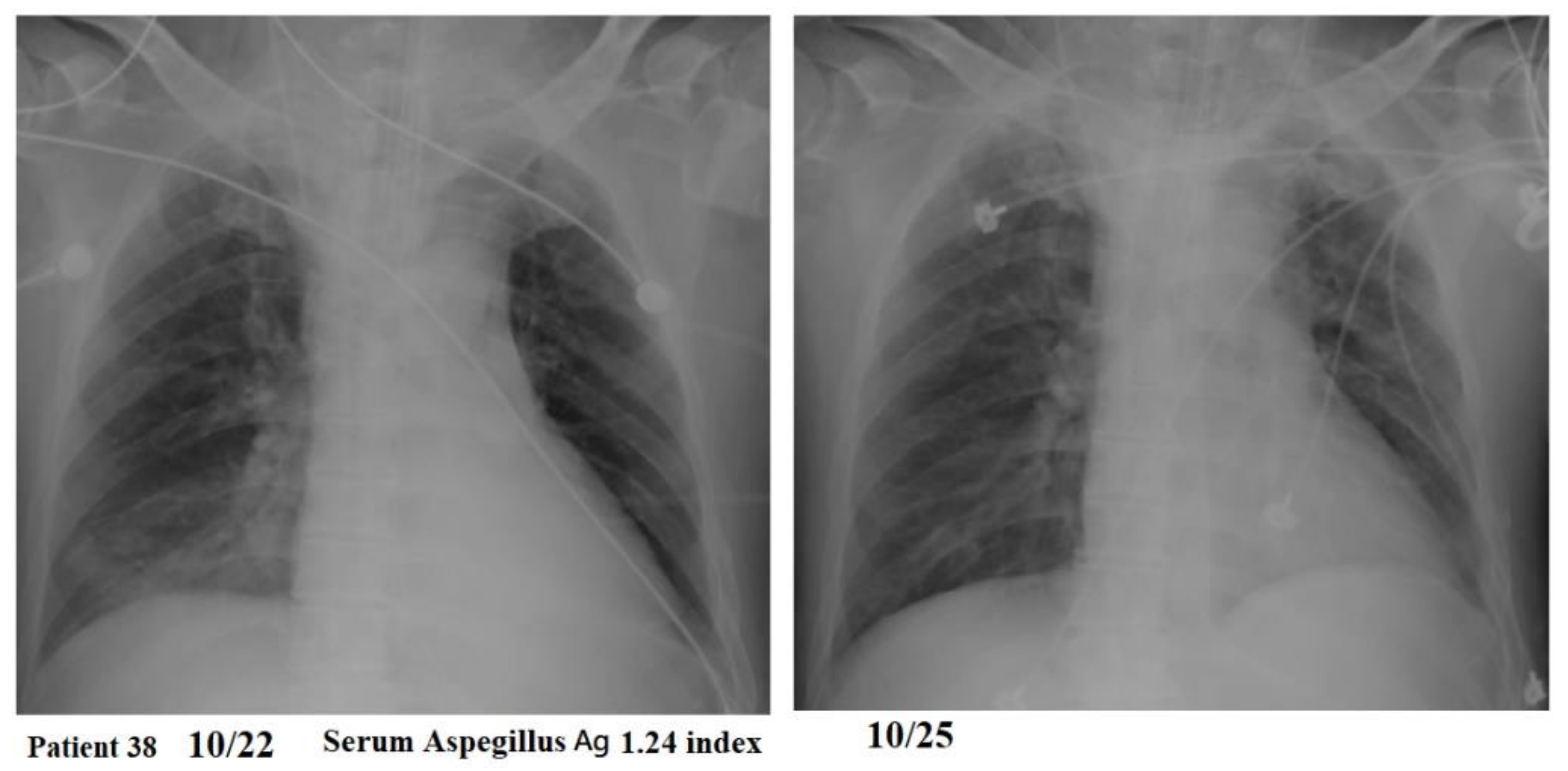 Jof 07 00922 g004 550