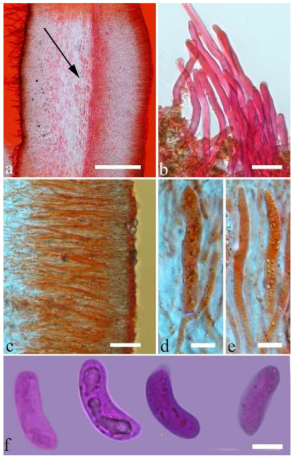 Jof 07 00933 g013 550