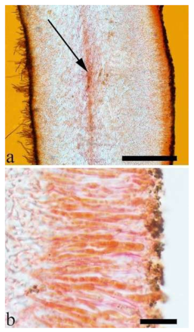 Jof 07 00933 g019 550