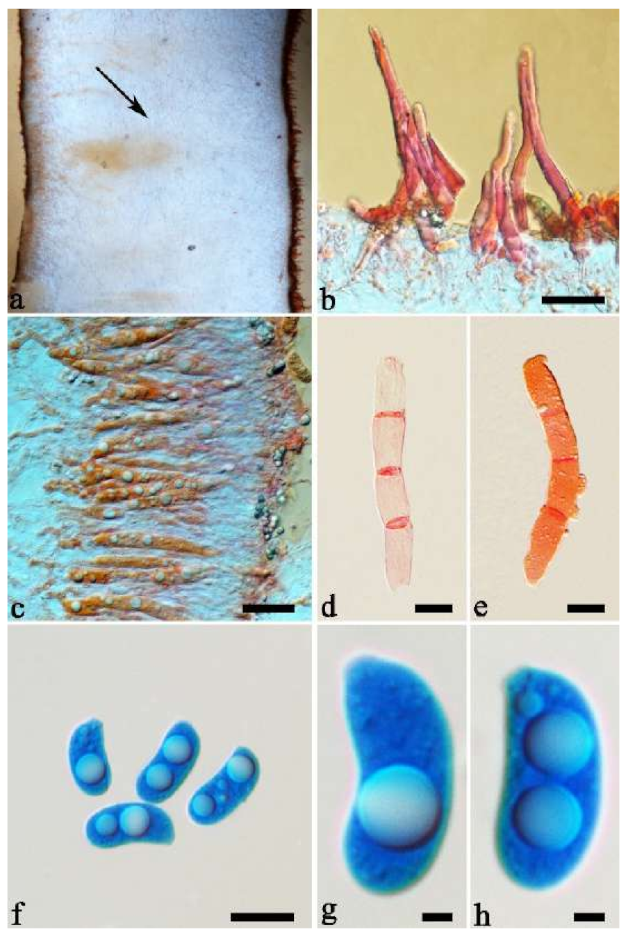 Jof 07 00933 g028 550