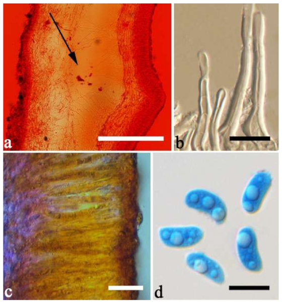 Jof 07 00933 g035 550