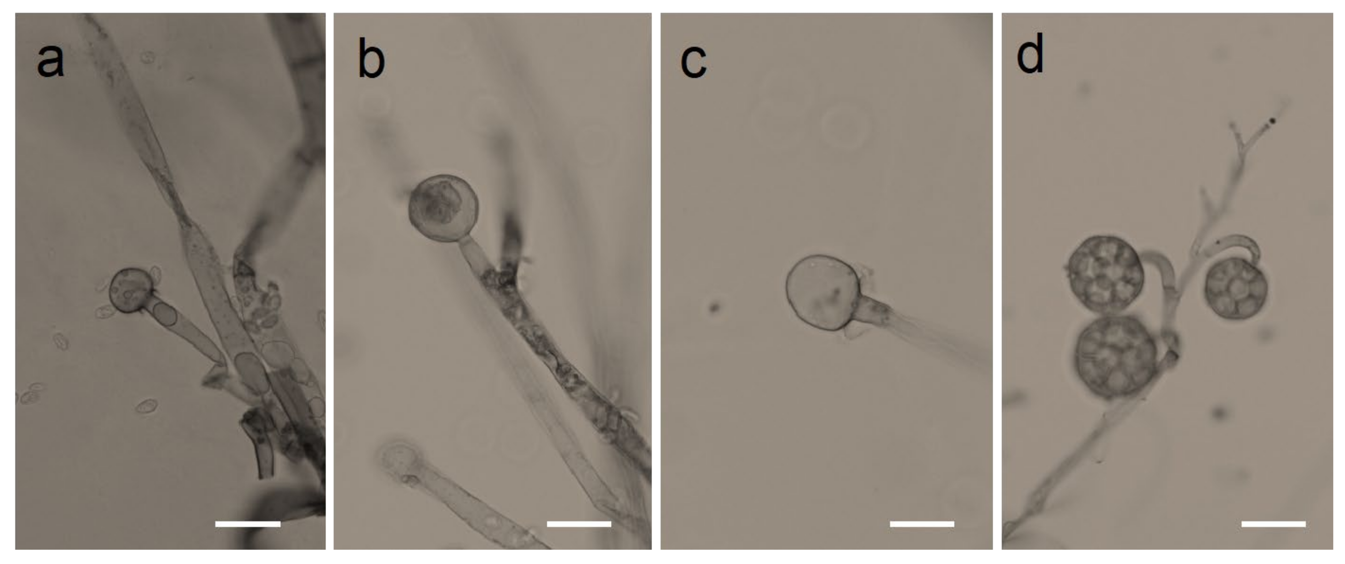 Mucor Under Microscope