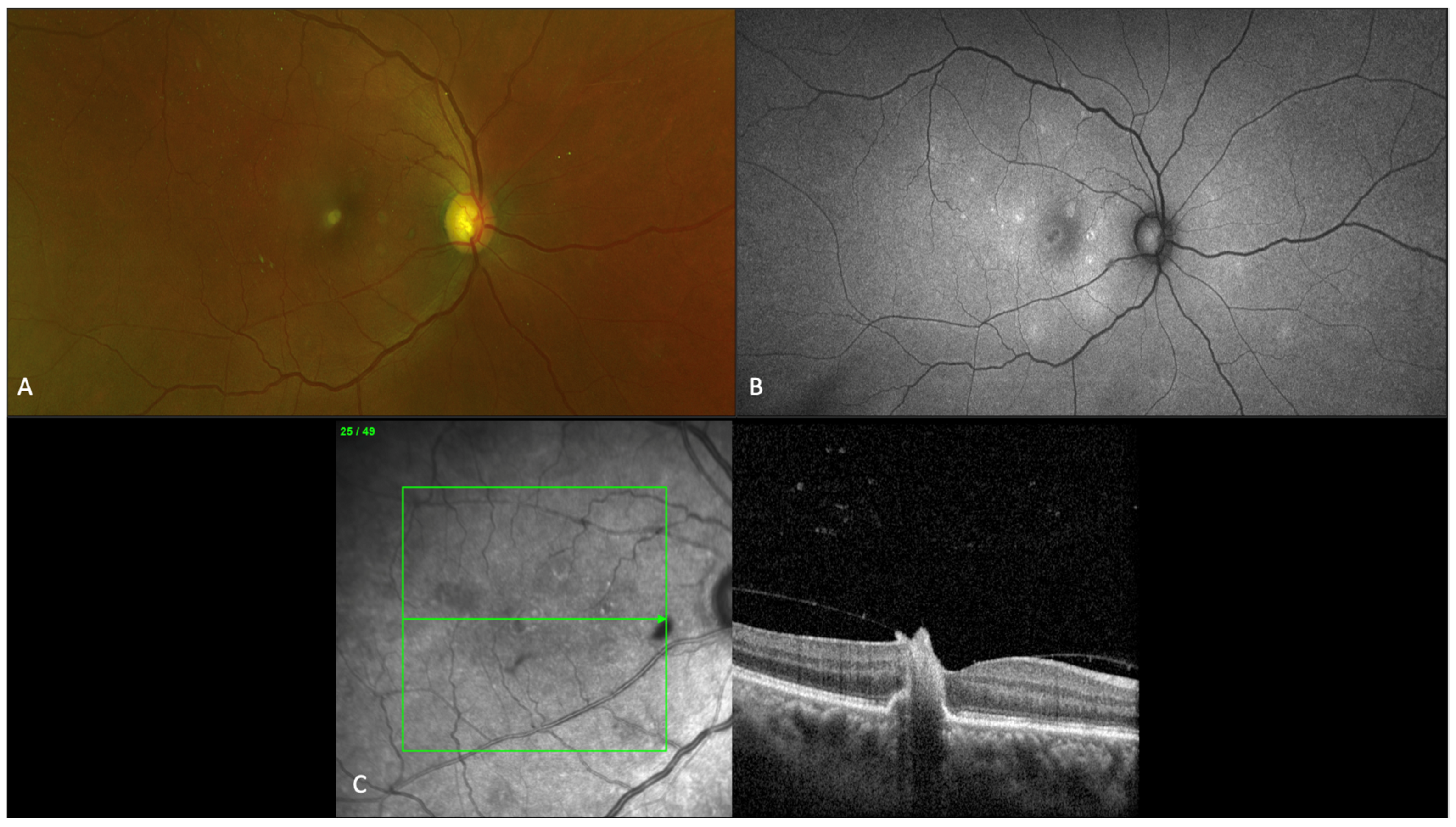 Jof 07 00996 g004 Jof 07 00996 g004