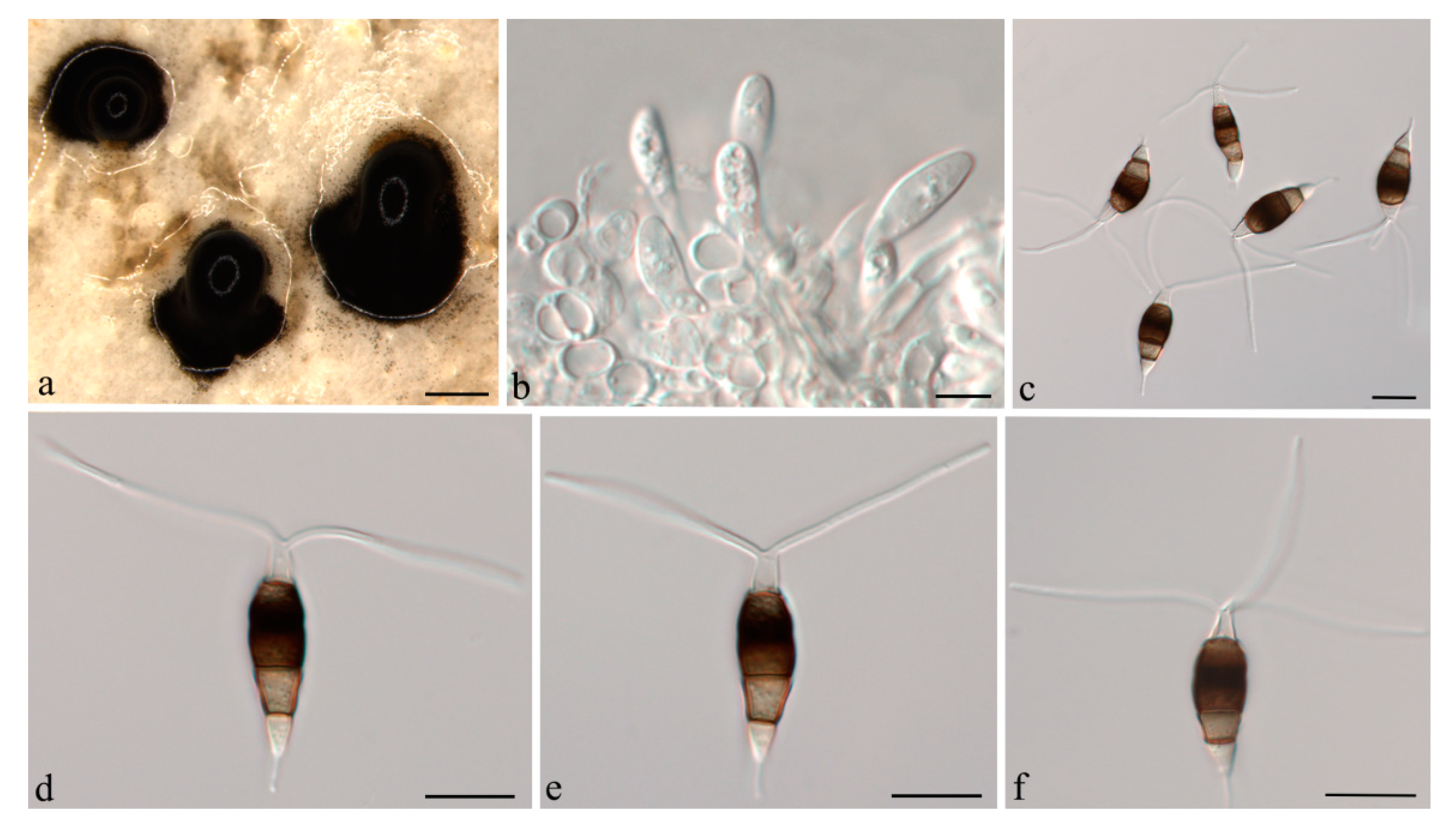 Jof 07 01080 g004 Jof 07 01080 g004