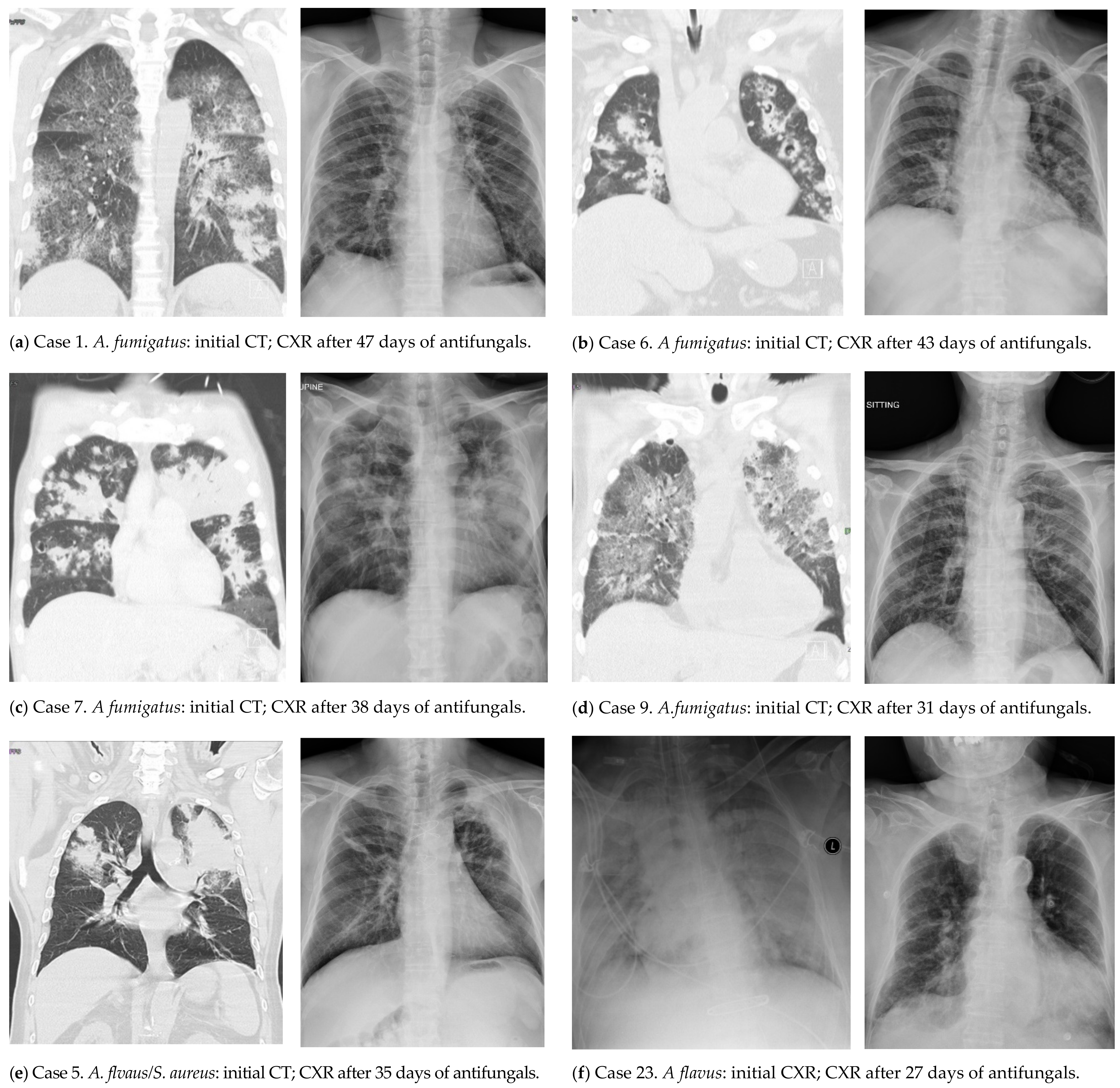 Jof 08 00049 g002 Jof 08 00049 g002