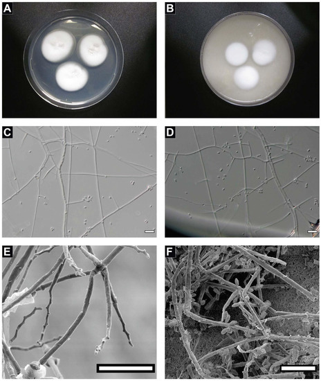 Genomic Characterization of <i>Parengyodontium torokii</i> sp. nov., a Biofilm-Forming Fungus Isolated from Mars 2020 Assembly Facility