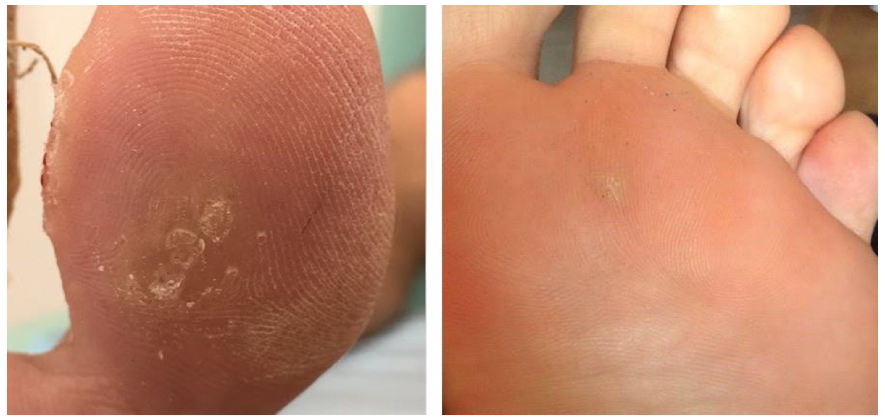 Jof 08 00135 g002 550