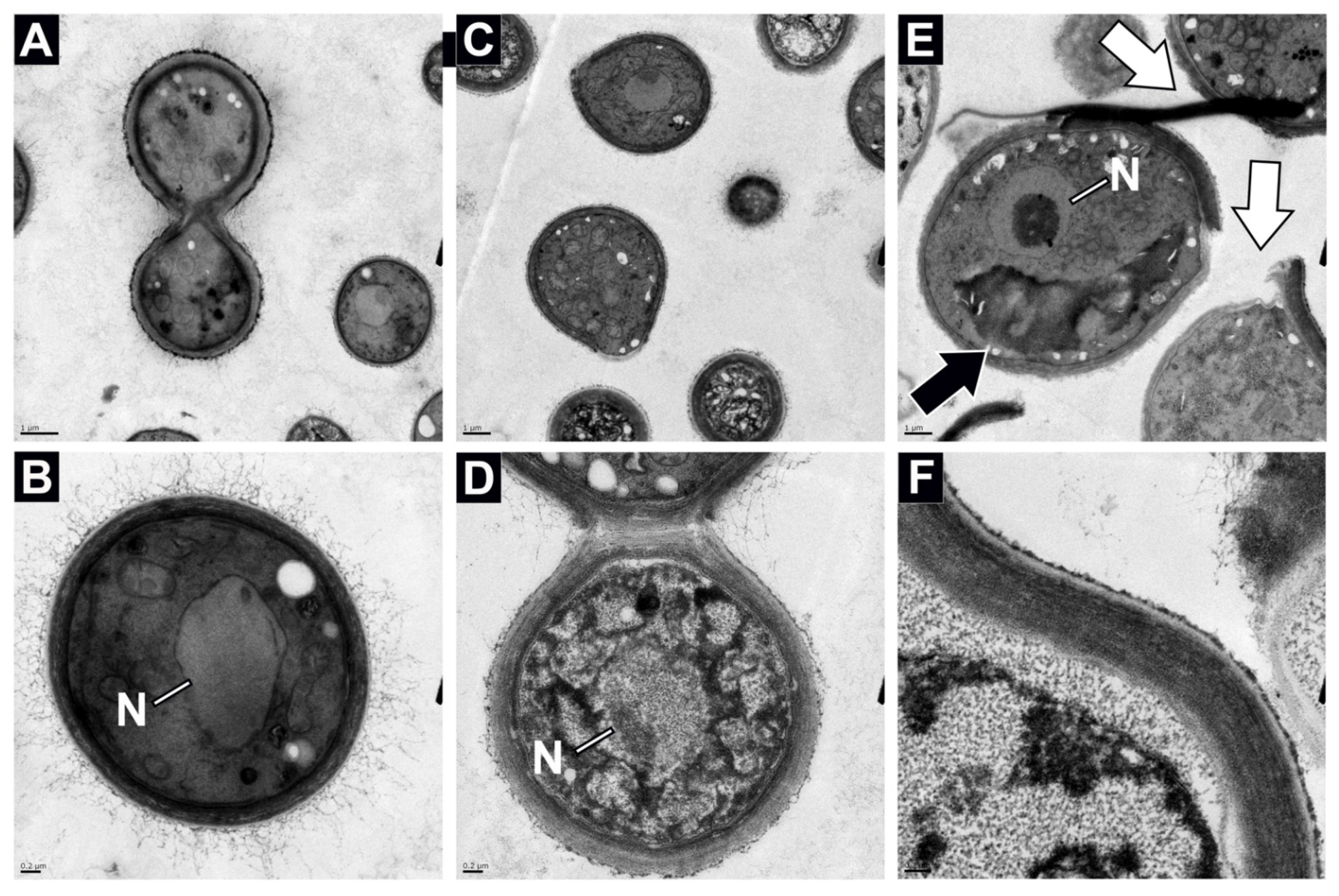 Jof 08 00165 g004 Jof 08 00165 g004