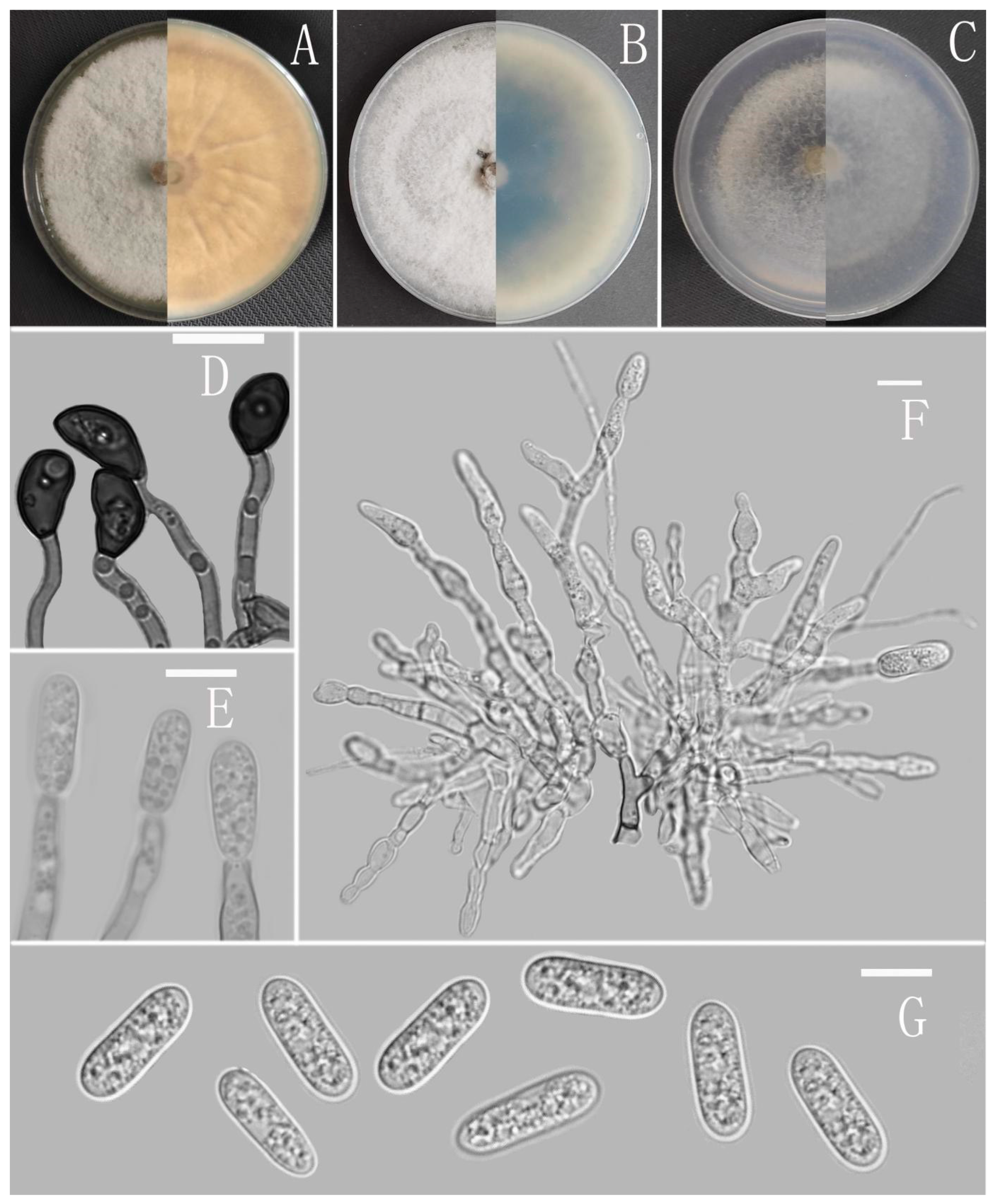 Jof 08 00185 g005 Jof 08 00185 g005